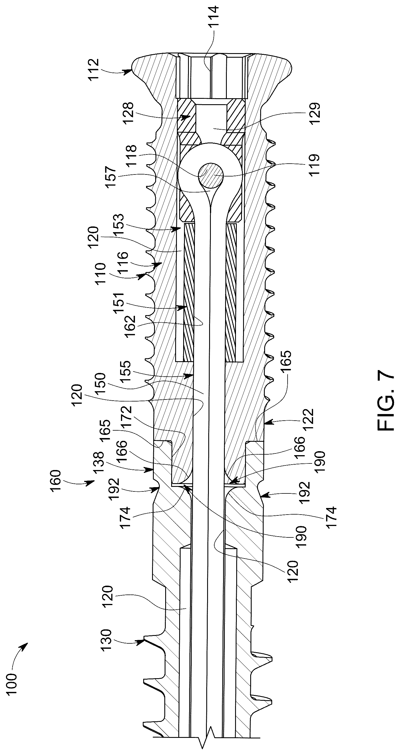 Patent US12303377 Figure 7 – Dynamic fixation implant and method of use