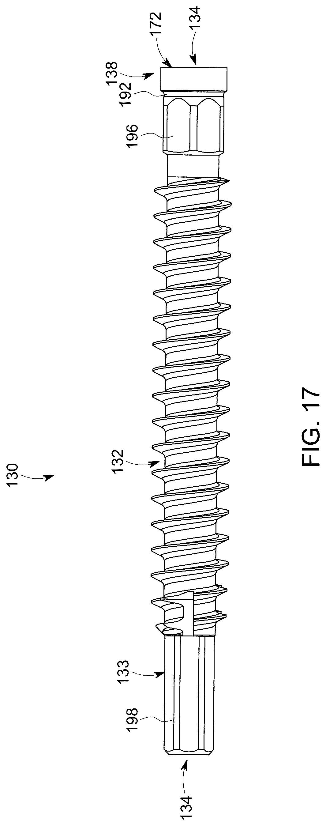 Patent US12303377 Figure 17 – Dynamic fixation implant and method of use