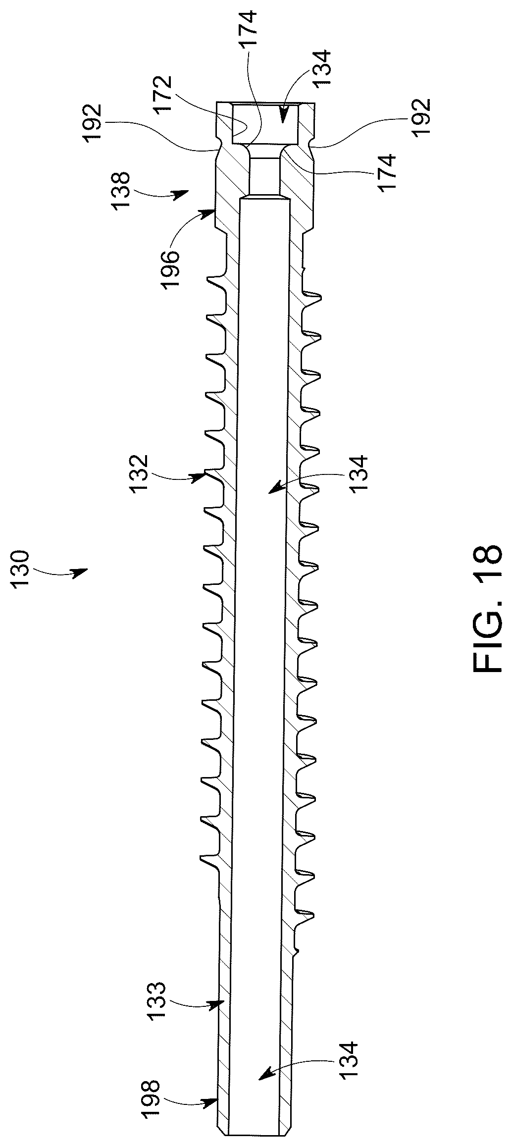 Patent US12303377 Figure 18 – Dynamic fixation implant and method of use