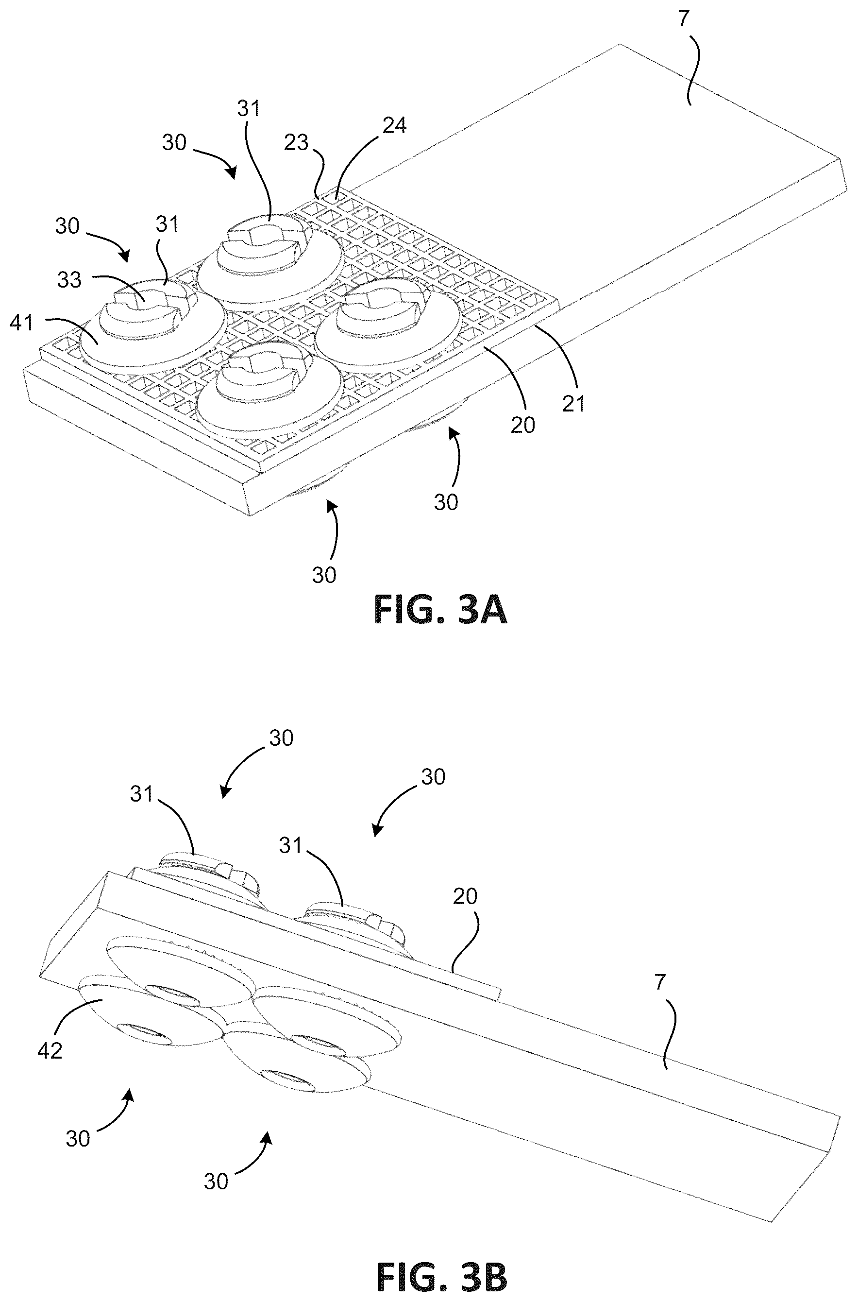 Patent US12303378 Figure 3 – Tendon repair system