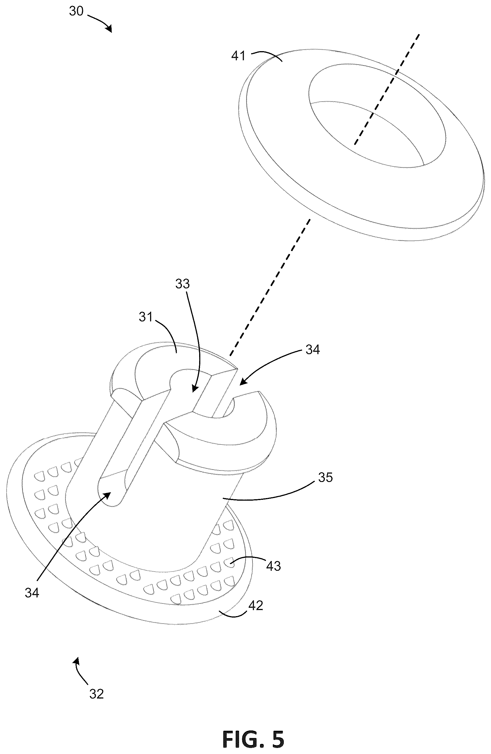 Patent US12303378 Figure 5 – Tendon repair system