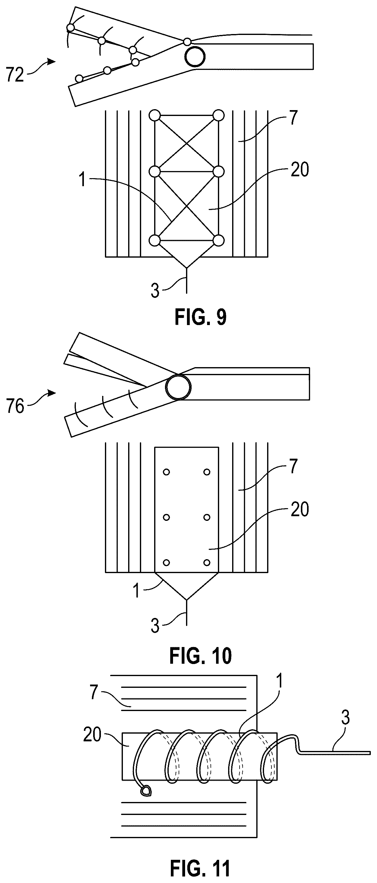 Patent US12303378 Figure 9 – Tendon repair system