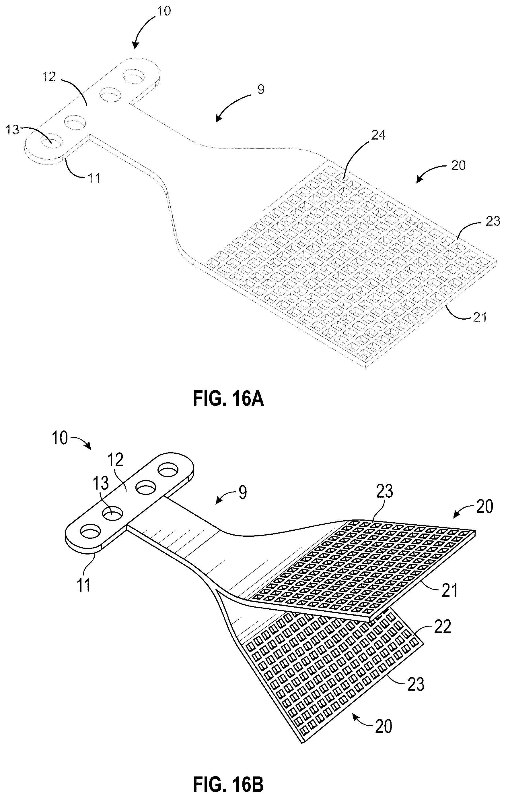 Patent US12303378 Figure 14 – Tendon repair system