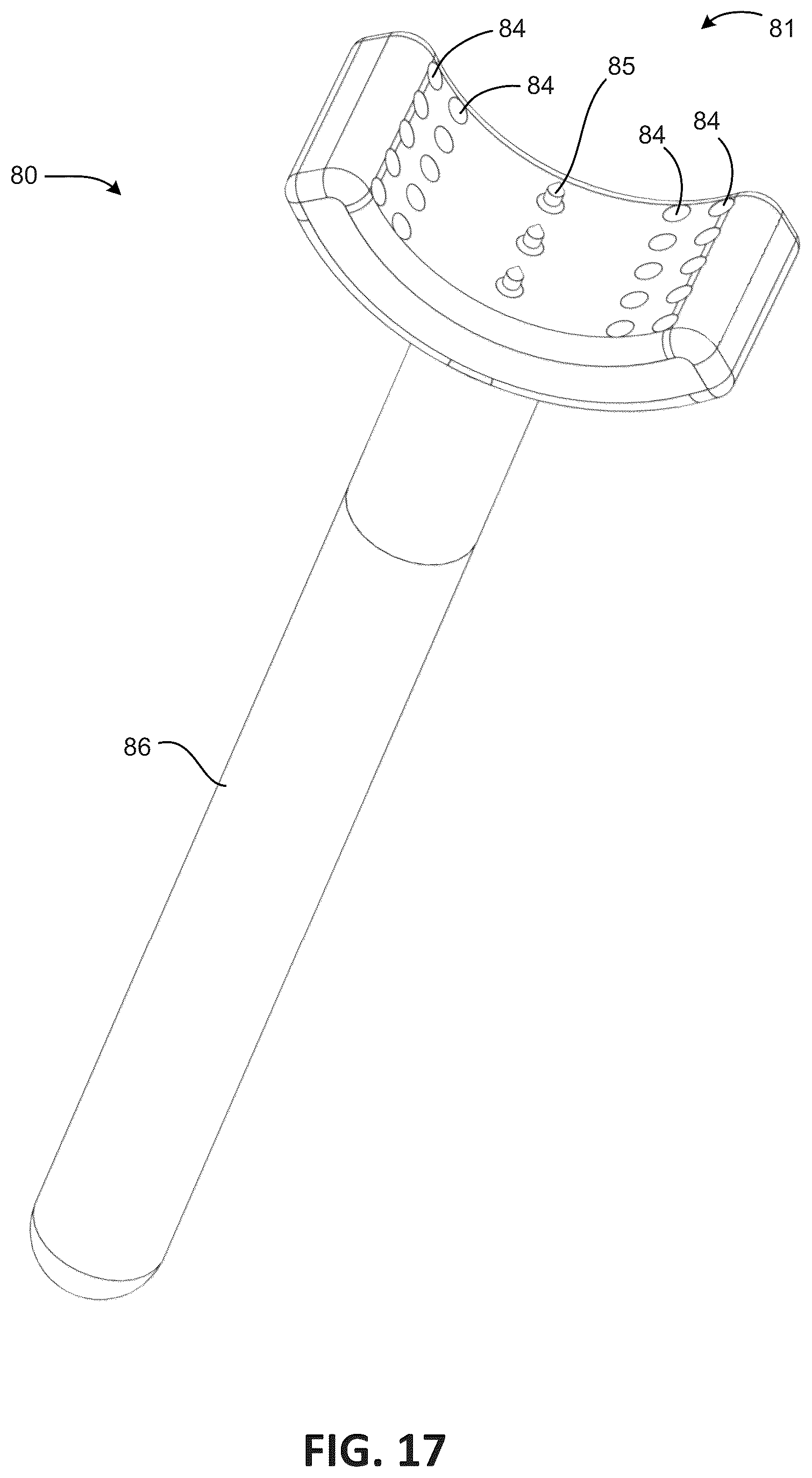 Patent US12303378 Figure 15 – Tendon repair system