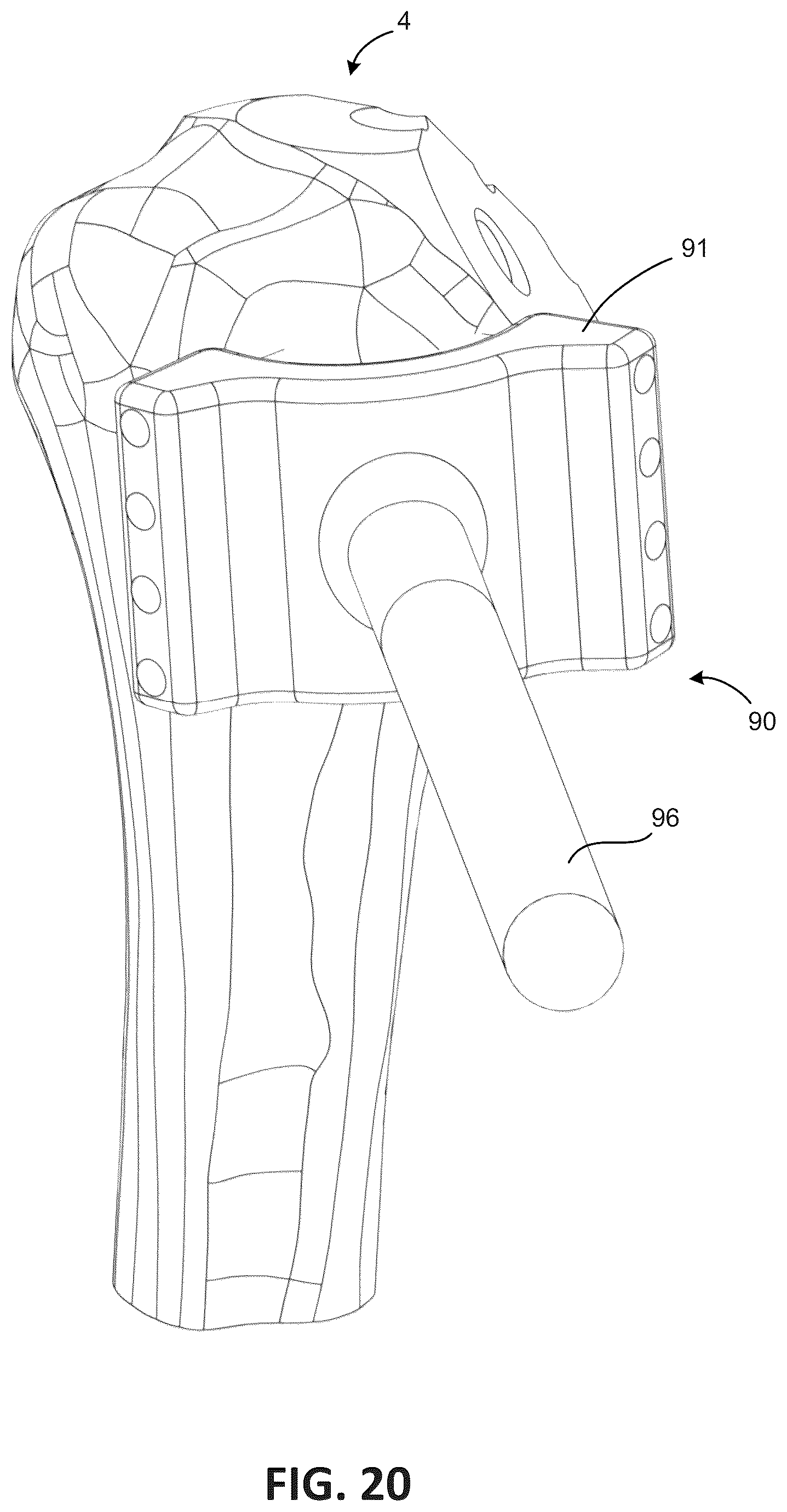 Patent US12303378 Figure 18 – Tendon repair system