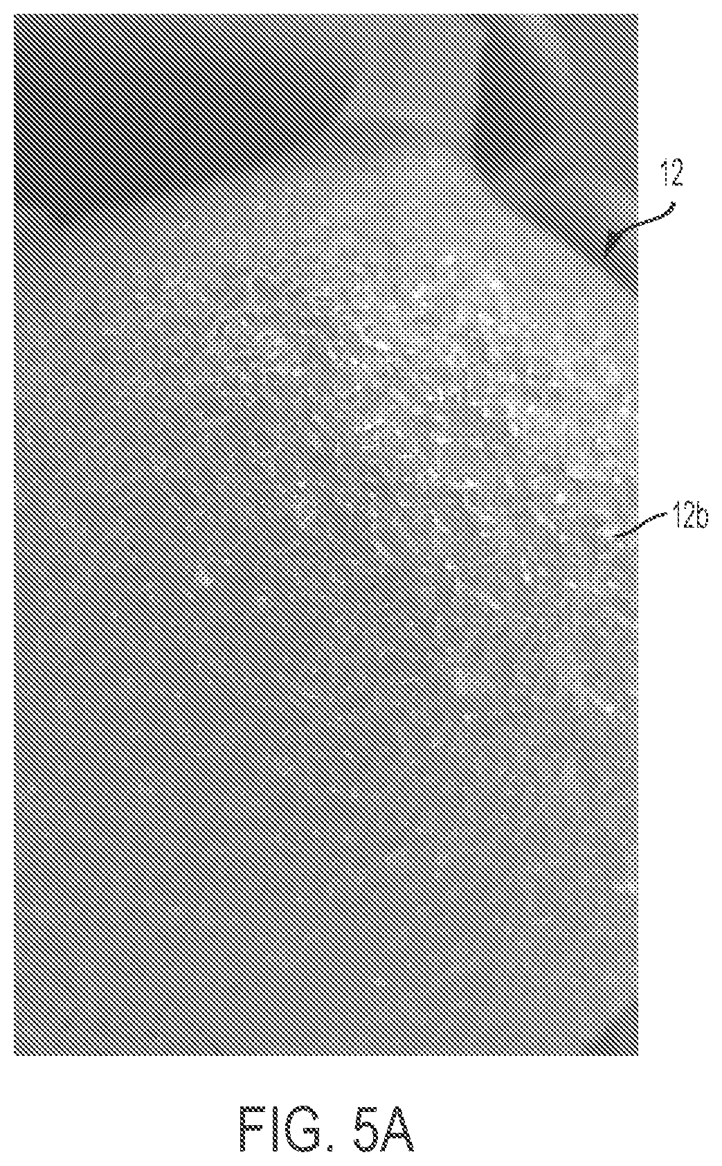 Patent US12303379 Figure 4 – Implant with elastomeric membrane and methods of fabrication thereof