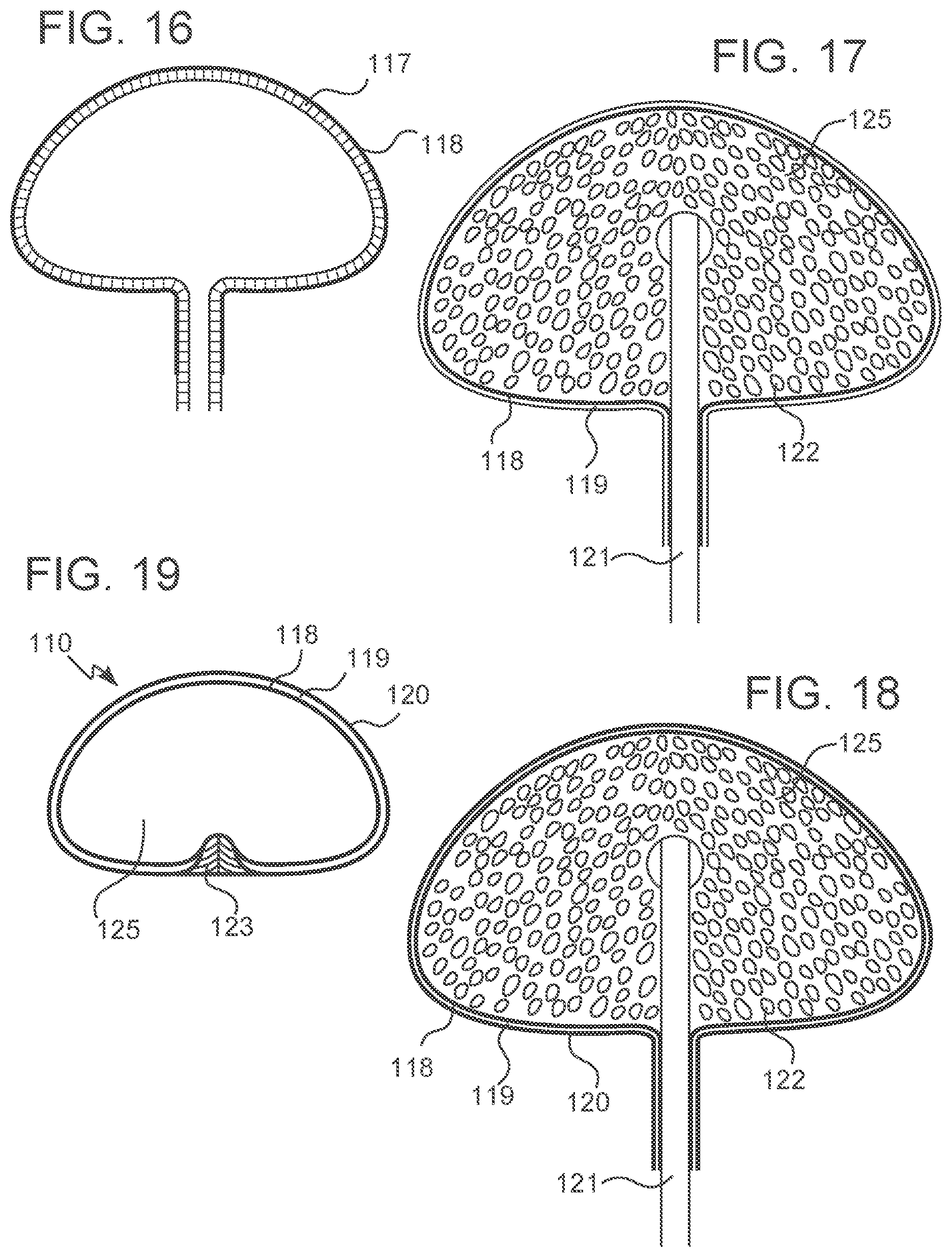 Patent US12303379 Figure 8 – Implant with elastomeric membrane and methods of fabrication thereof