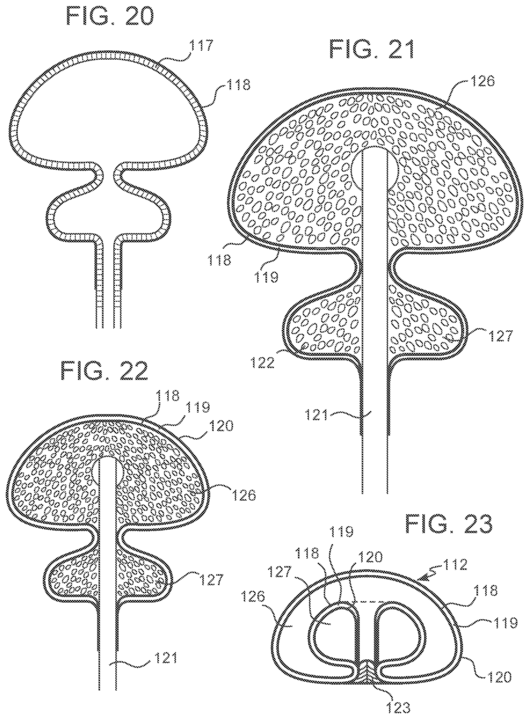 Patent US12303379 Figure 9 – Implant with elastomeric membrane and methods of fabrication thereof
