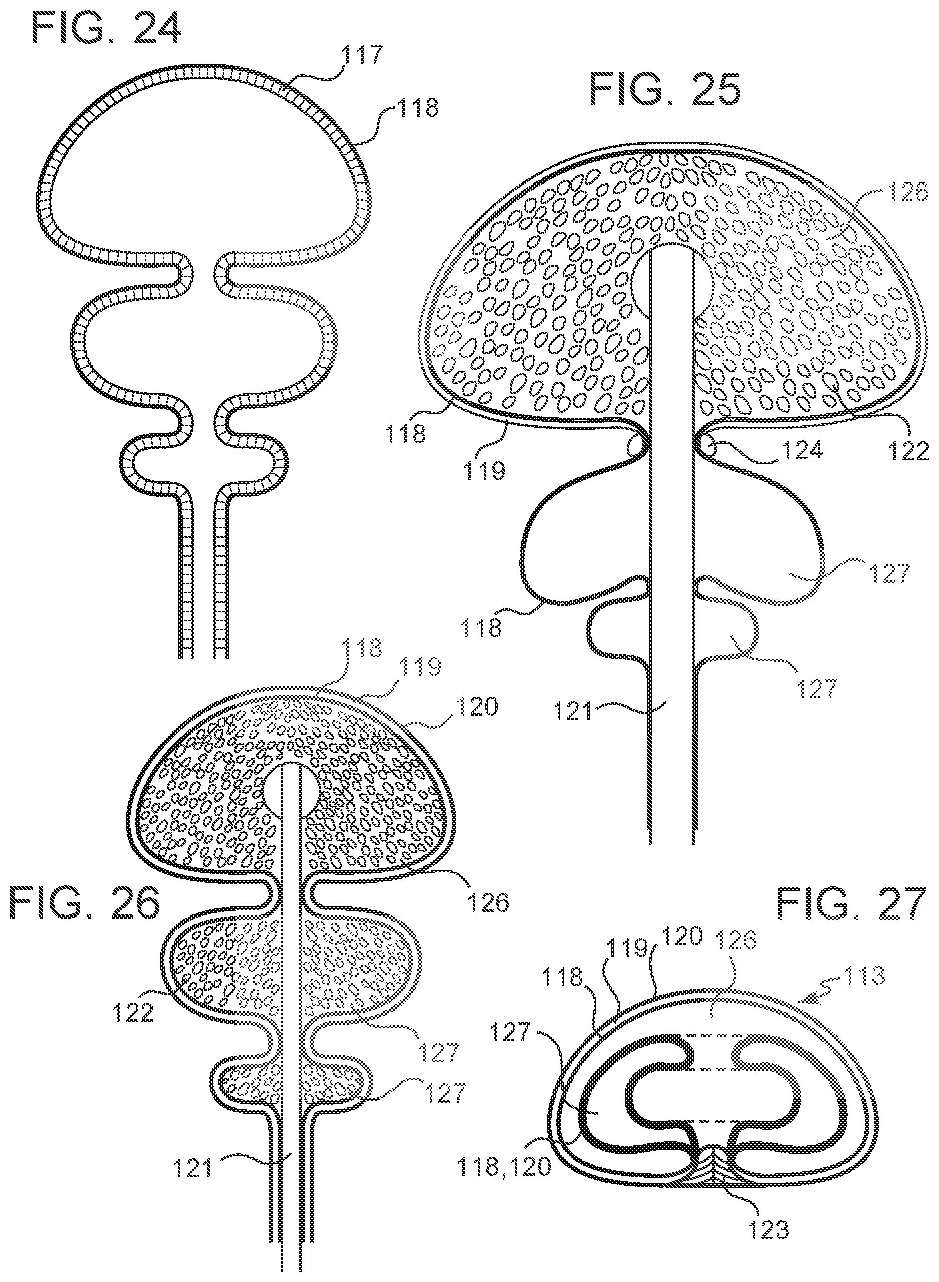 Patent US12303379 Figure 10 – Implant with elastomeric membrane and methods of fabrication thereof