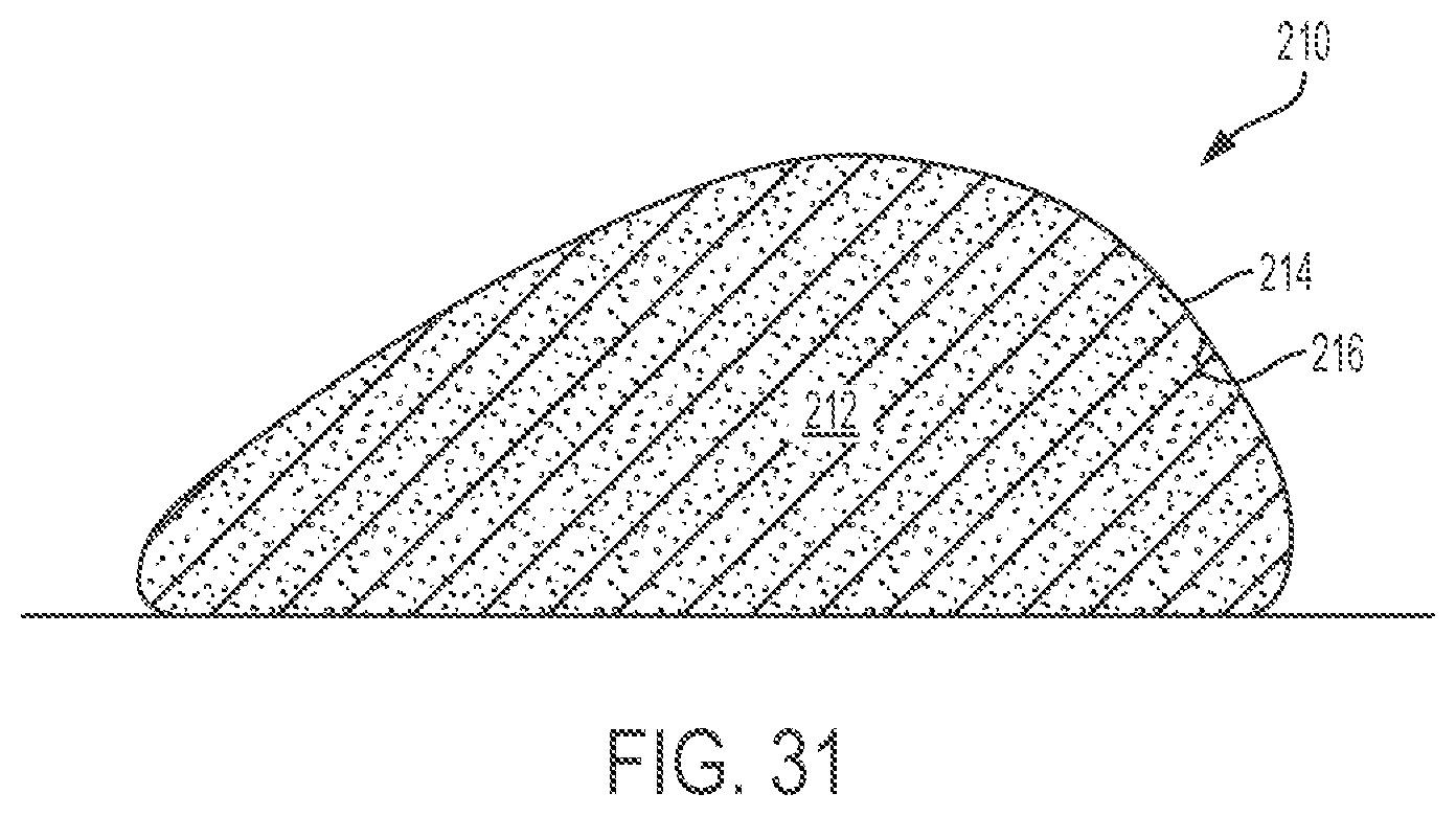 Patent US12303379 Figure 12 – Implant with elastomeric membrane and methods of fabrication thereof