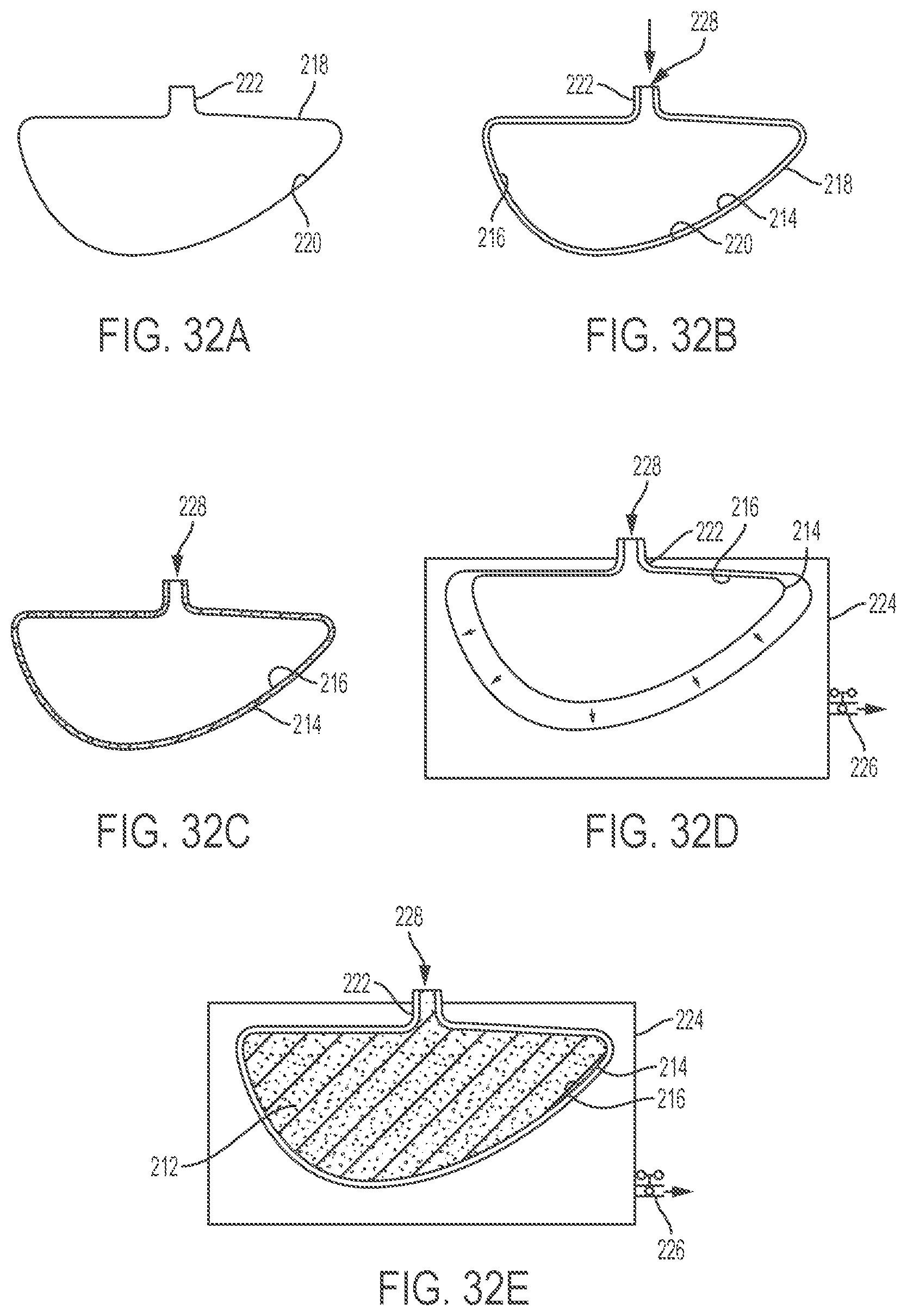 Patent US12303379 Figure 13 – Implant with elastomeric membrane and methods of fabrication thereof
