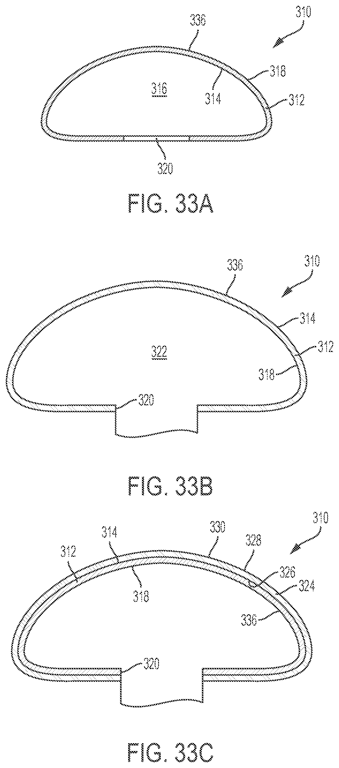 Patent US12303379 Figure 14 – Implant with elastomeric membrane and methods of fabrication thereof