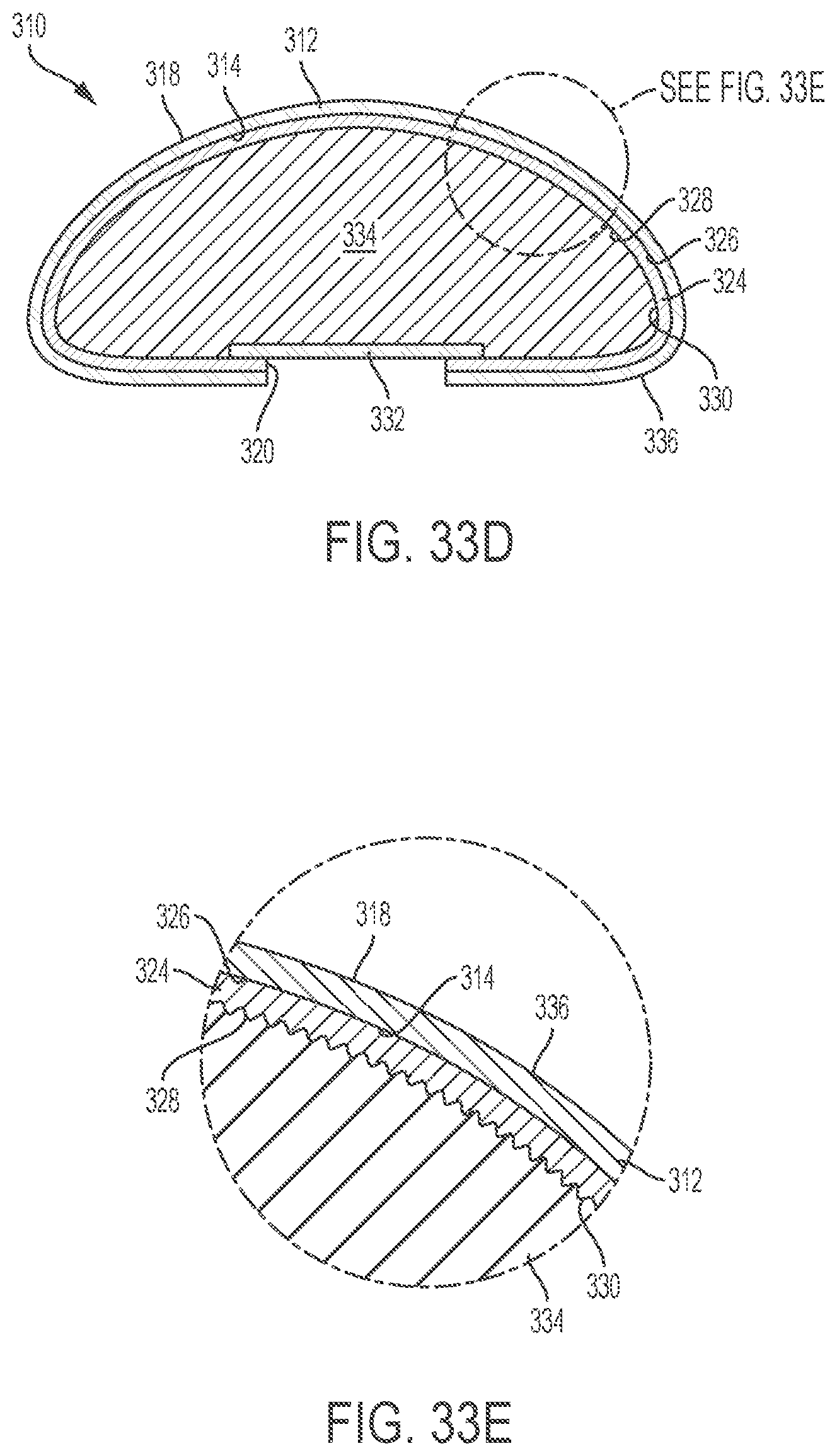 Patent US12303379 Figure 15 – Implant with elastomeric membrane and methods of fabrication thereof