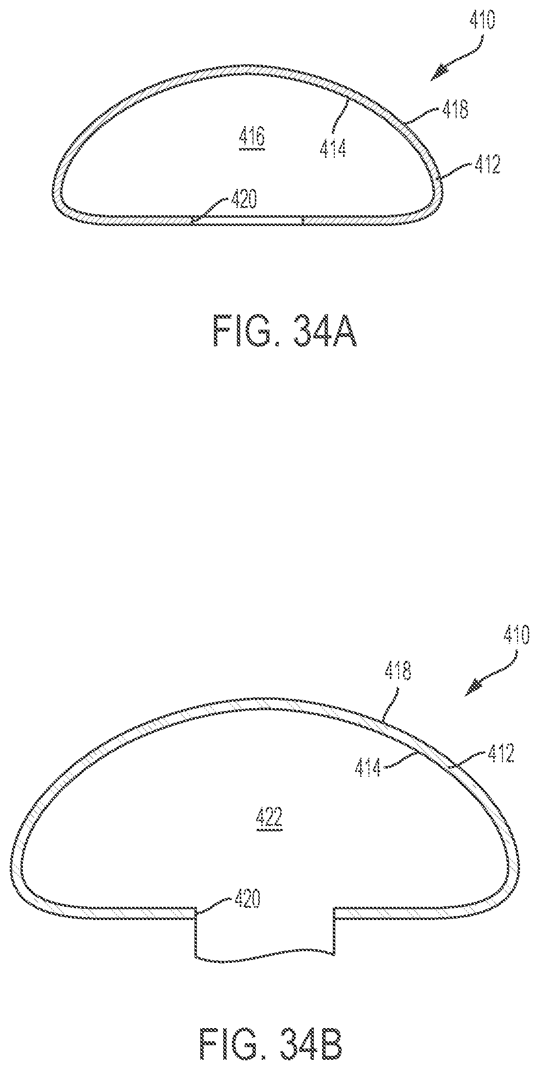 Patent US12303379 Figure 16 – Implant with elastomeric membrane and methods of fabrication thereof