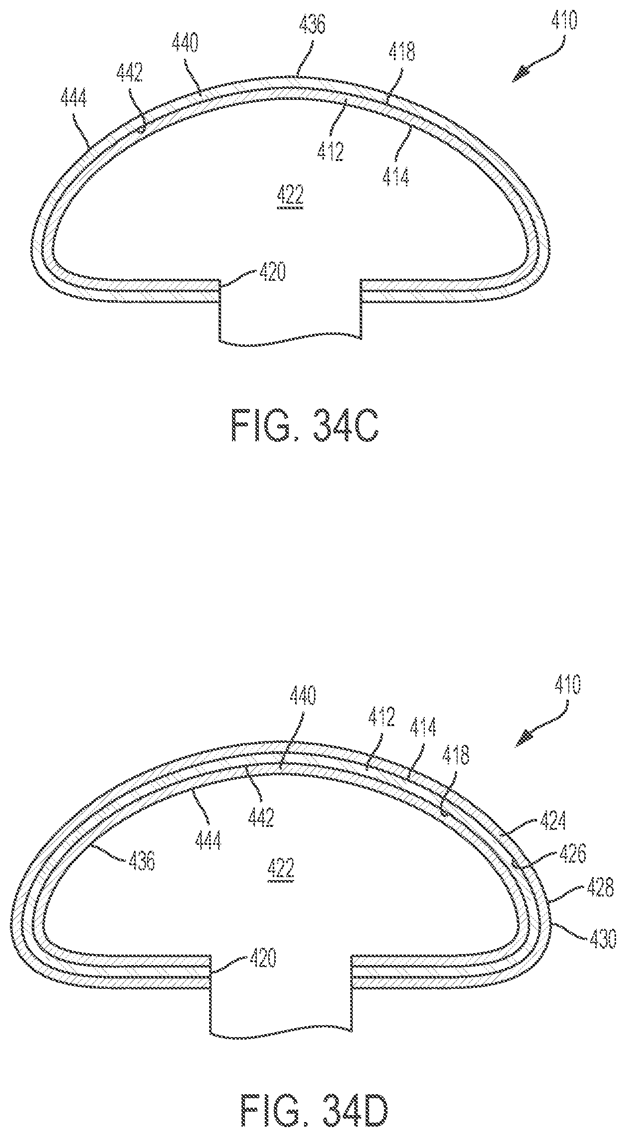 Patent US12303379 Figure 17 – Implant with elastomeric membrane and methods of fabrication thereof