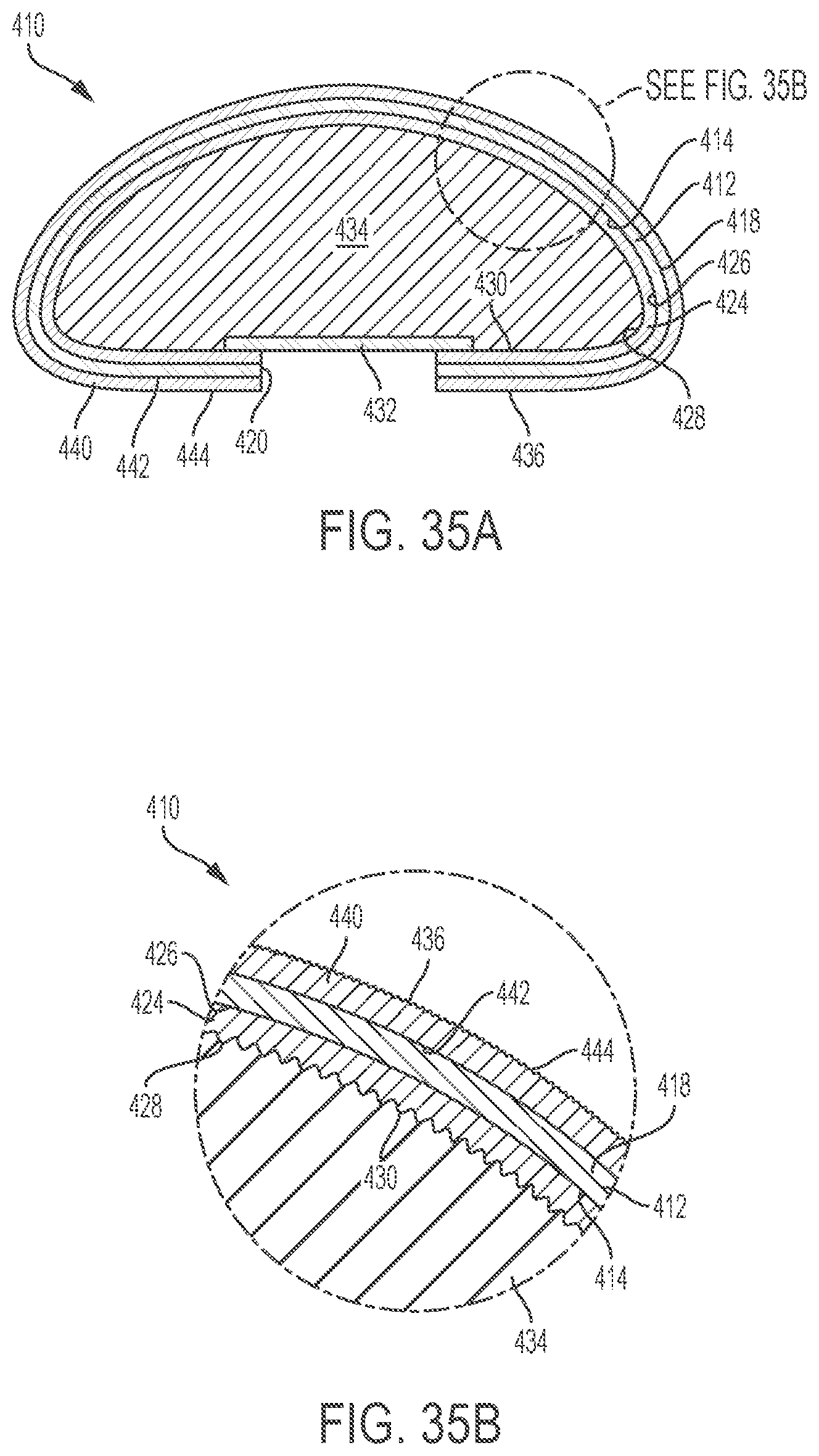 Patent US12303379 Figure 18 – Implant with elastomeric membrane and methods of fabrication thereof
