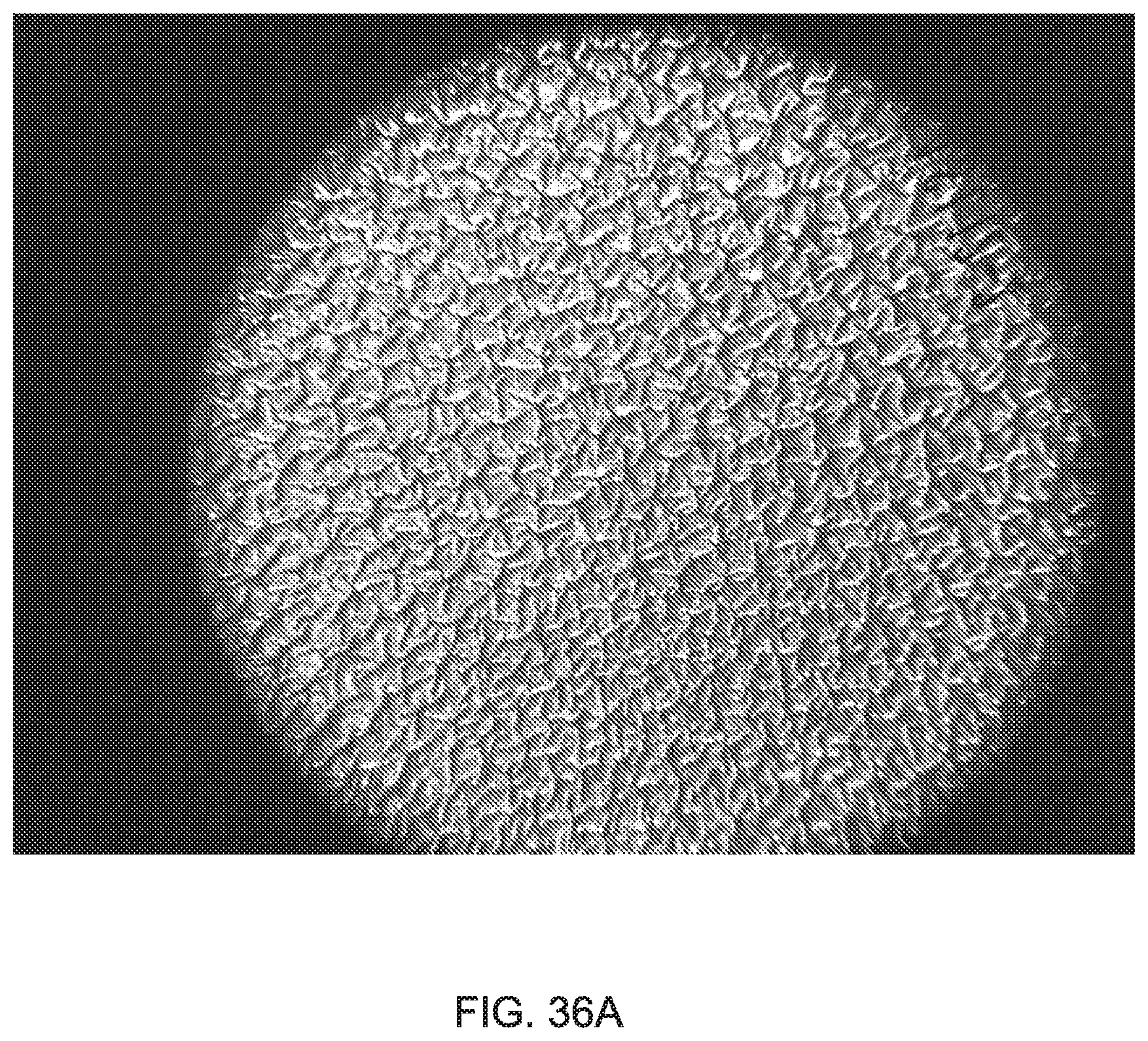 Patent US12303379 Figure 19 – Implant with elastomeric membrane and methods of fabrication thereof