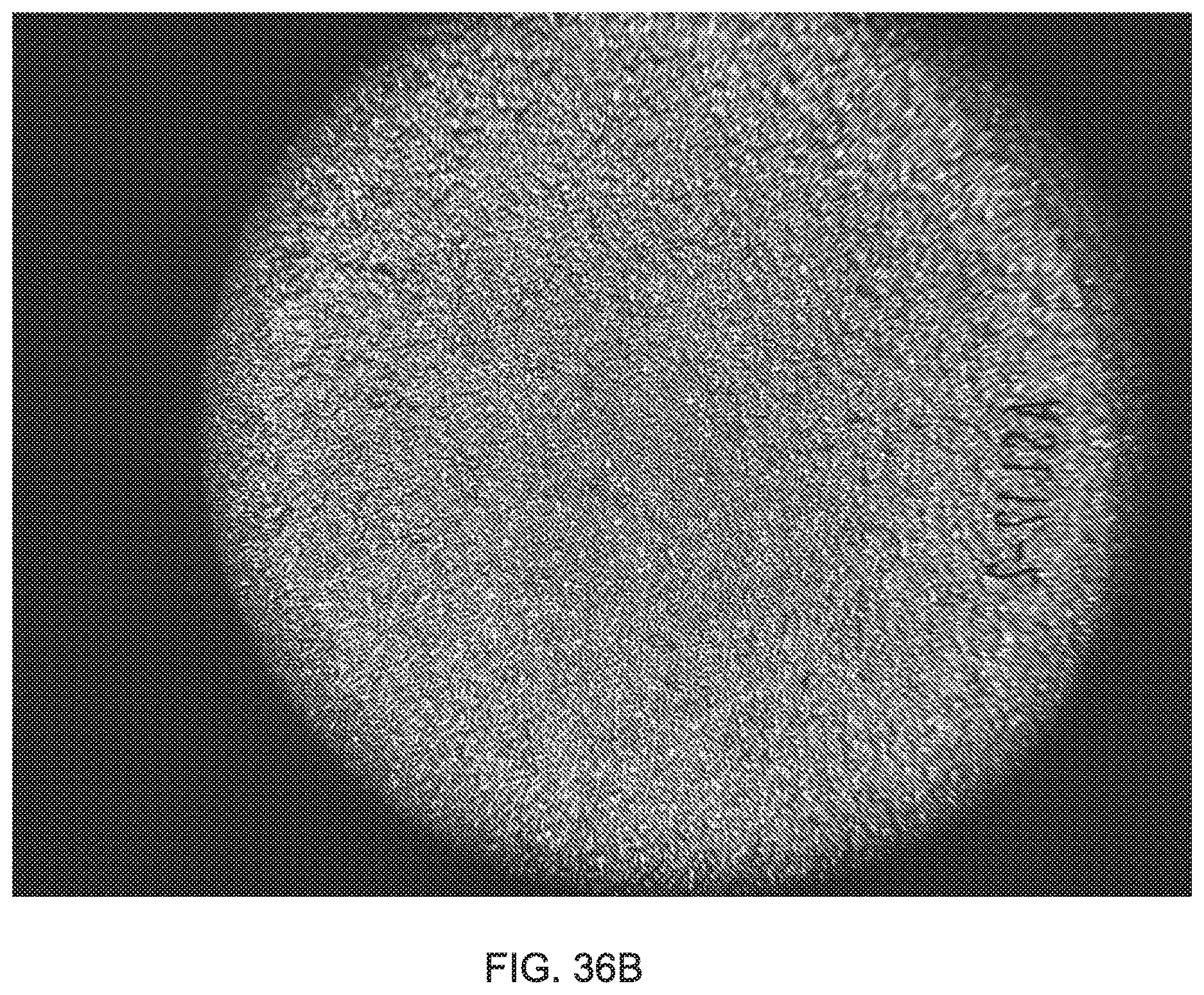 Patent US12303379 Figure 20 – Implant with elastomeric membrane and methods of fabrication thereof