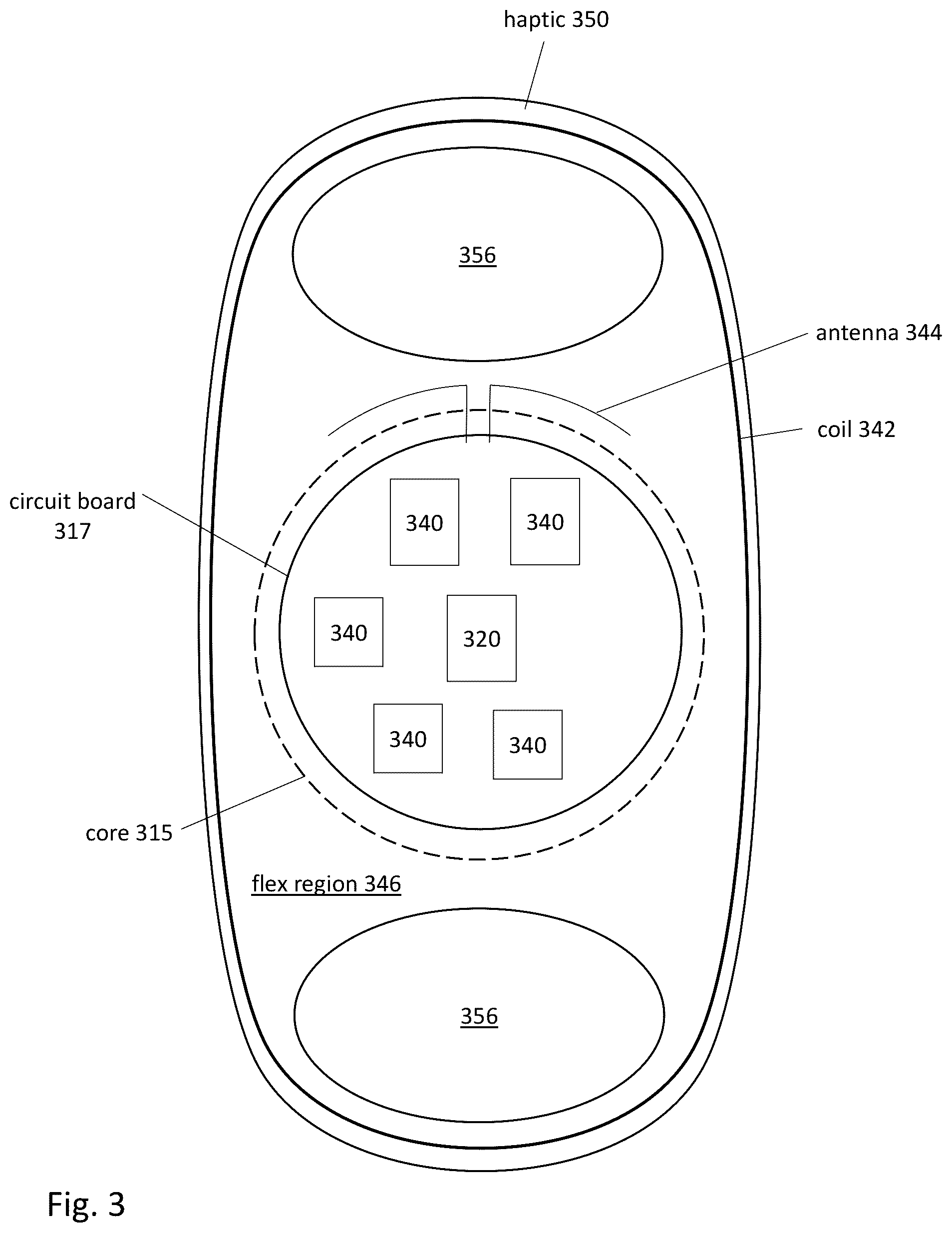 Patent US12303380 Figure 4 – Compensating corneal opacity