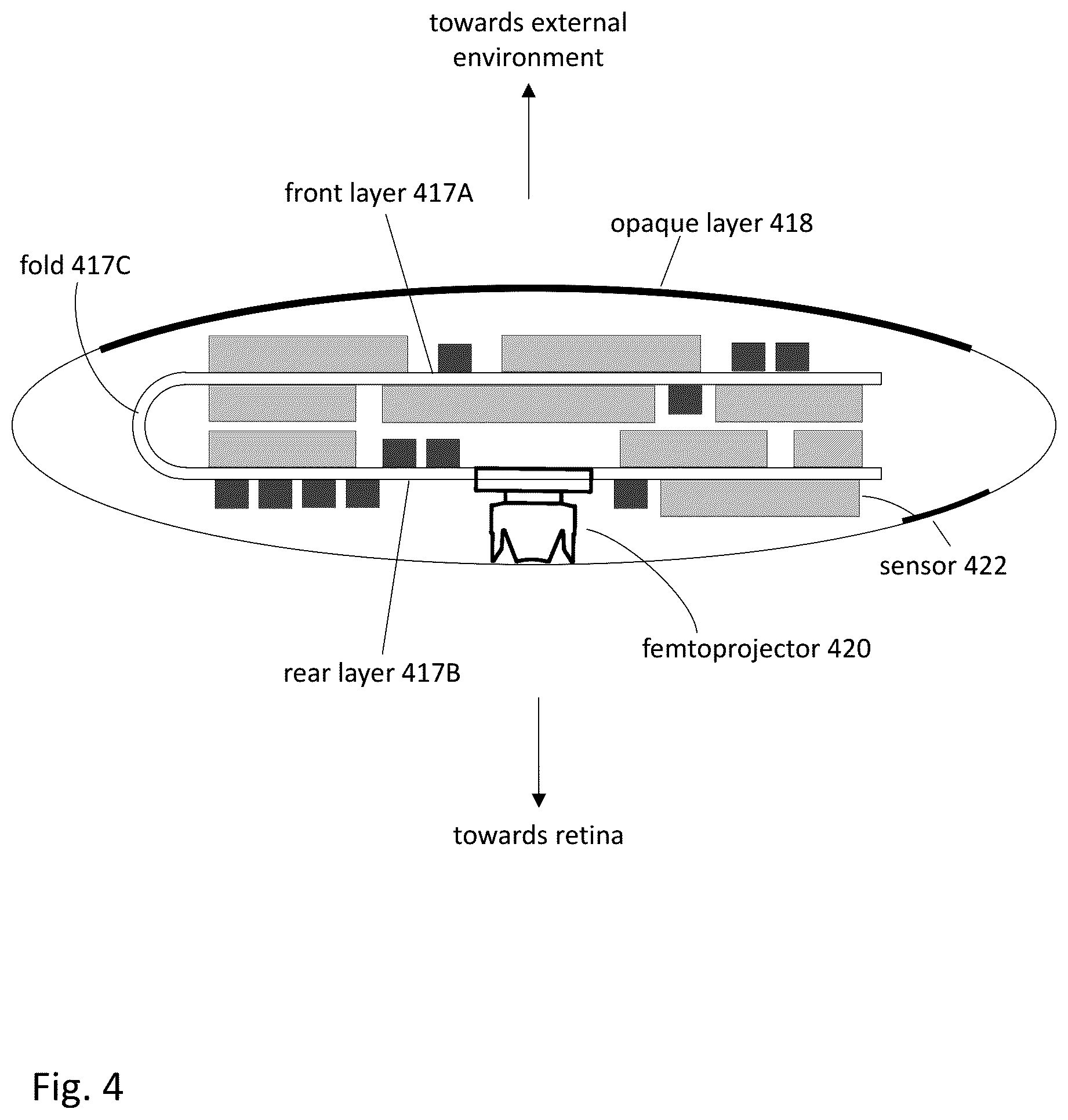 Patent US12303380 Figure 5 – Compensating corneal opacity