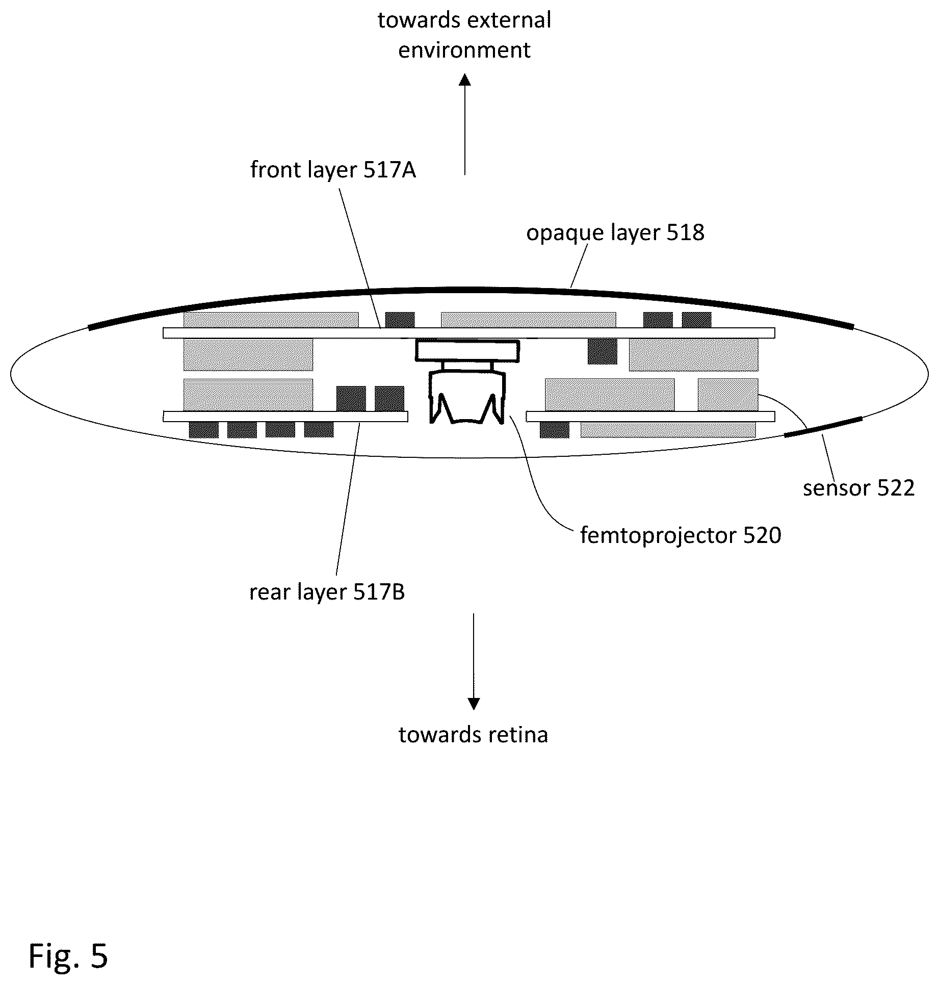 Patent US12303380 Figure 6 – Compensating corneal opacity