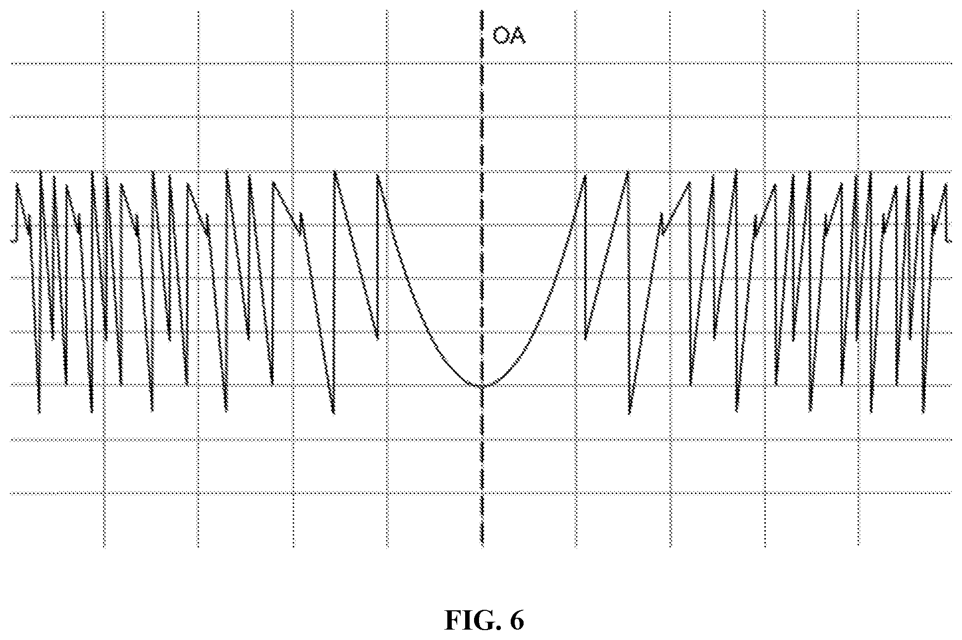 Patent US12303381 Figure 4 – Quint-focal diffractive intraocular lens