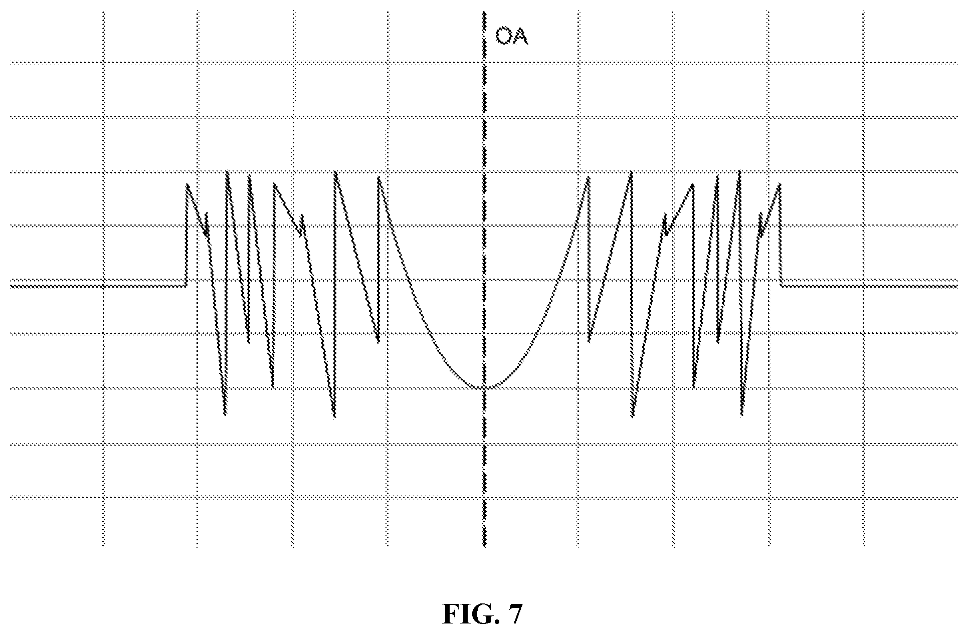 Patent US12303381 Figure 5 – Quint-focal diffractive intraocular lens