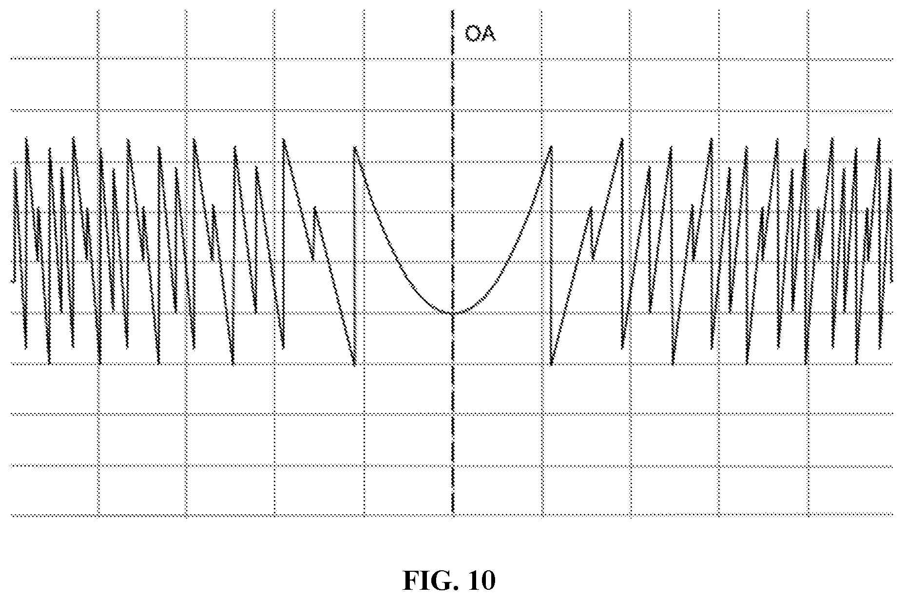Patent US12303381 Figure 7 – Quint-focal diffractive intraocular lens