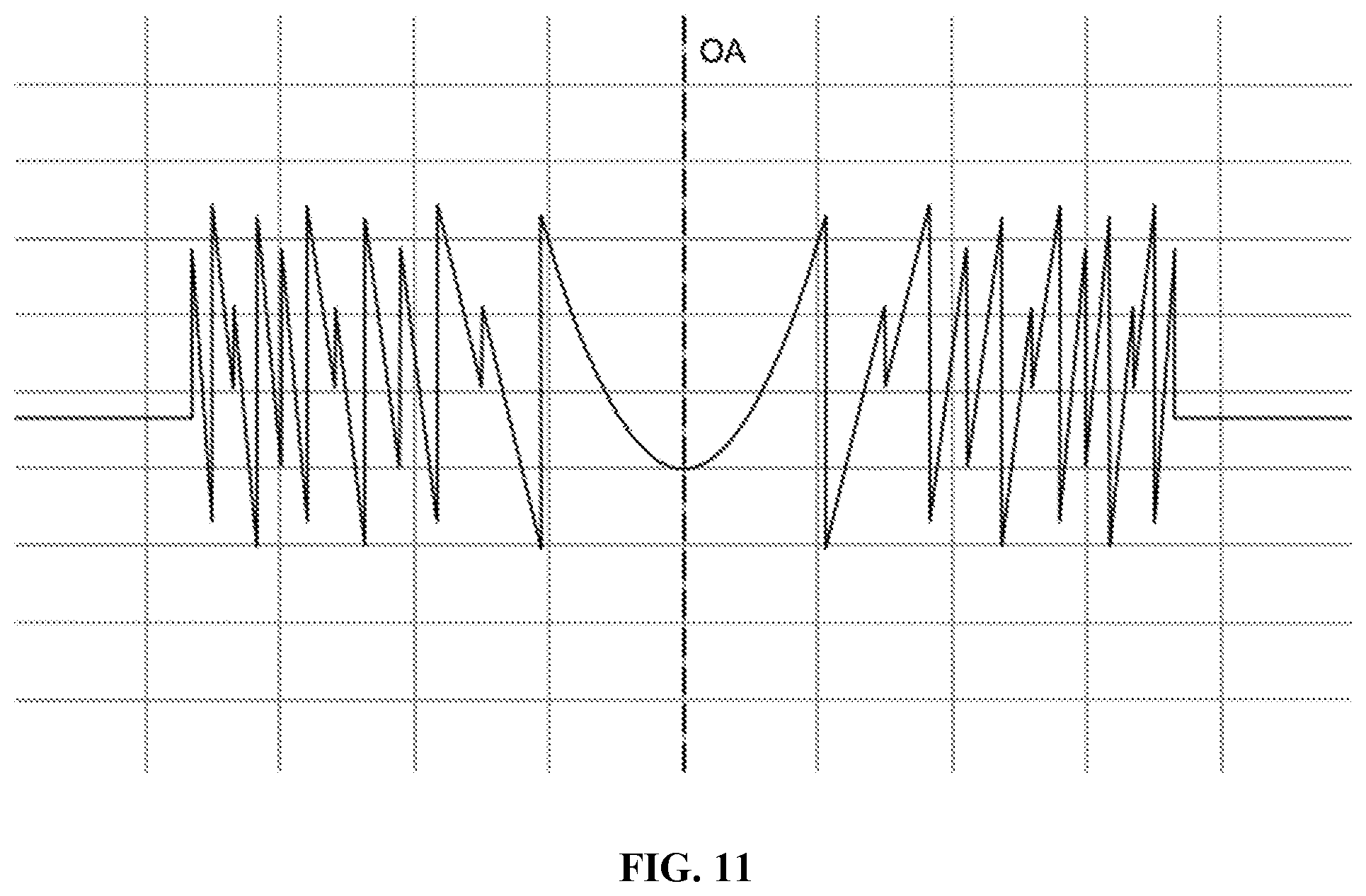 Patent US12303381 Figure 8 – Quint-focal diffractive intraocular lens