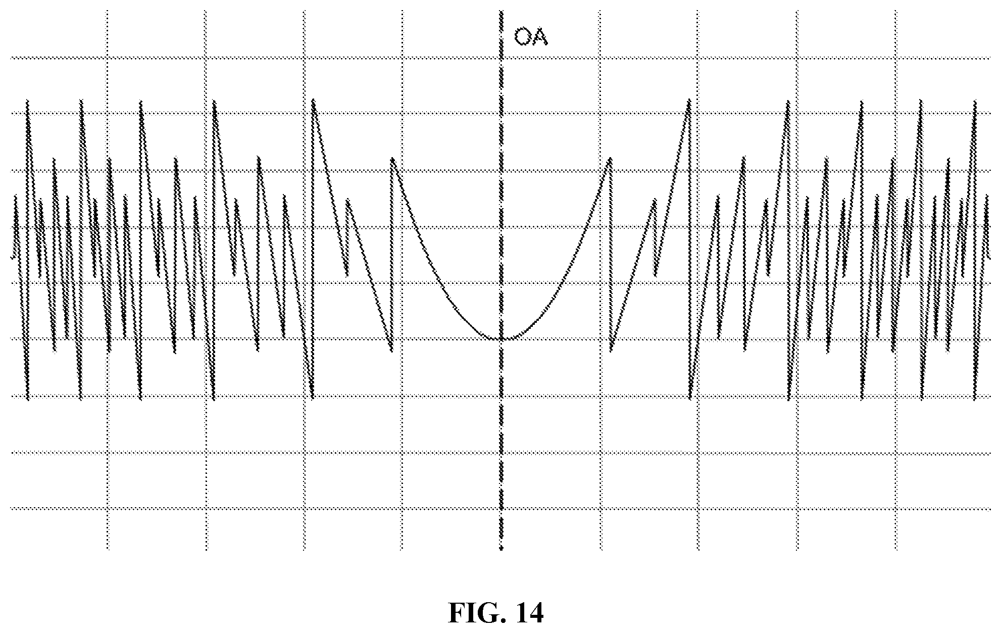 Patent US12303381 Figure 10 – Quint-focal diffractive intraocular lens