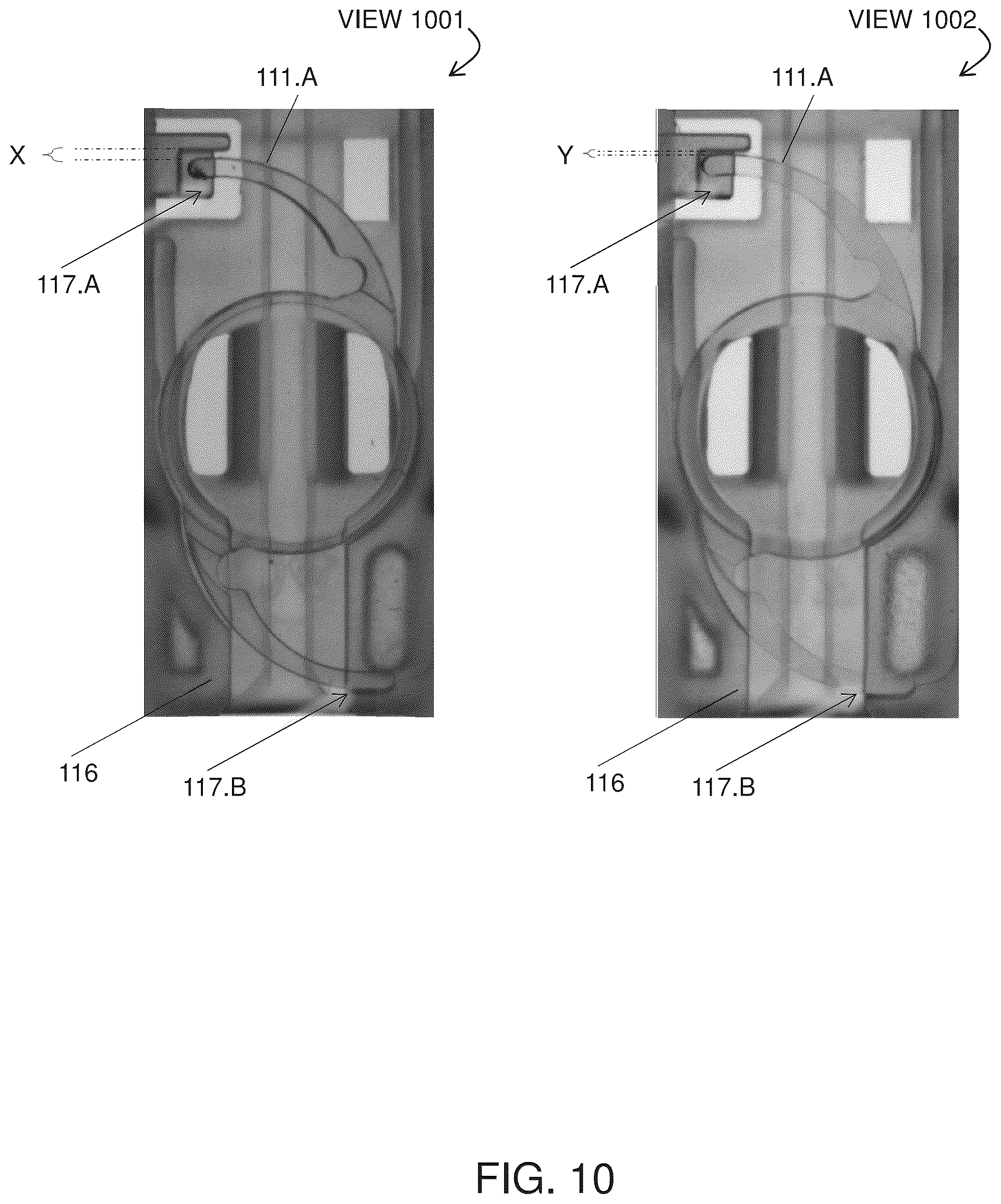 Patent US12303382 Figure 8 – Intraocular lens load assembly system