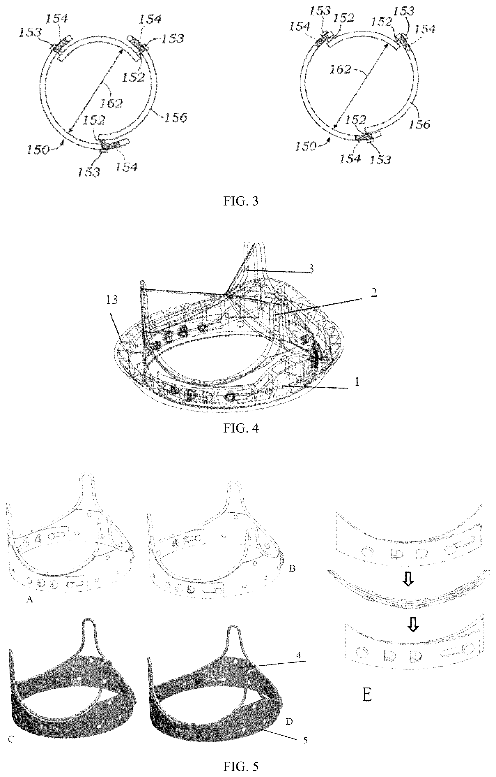 Patent US12303383 Figure 2 – One-way limiting expandable artificial biological heart valve