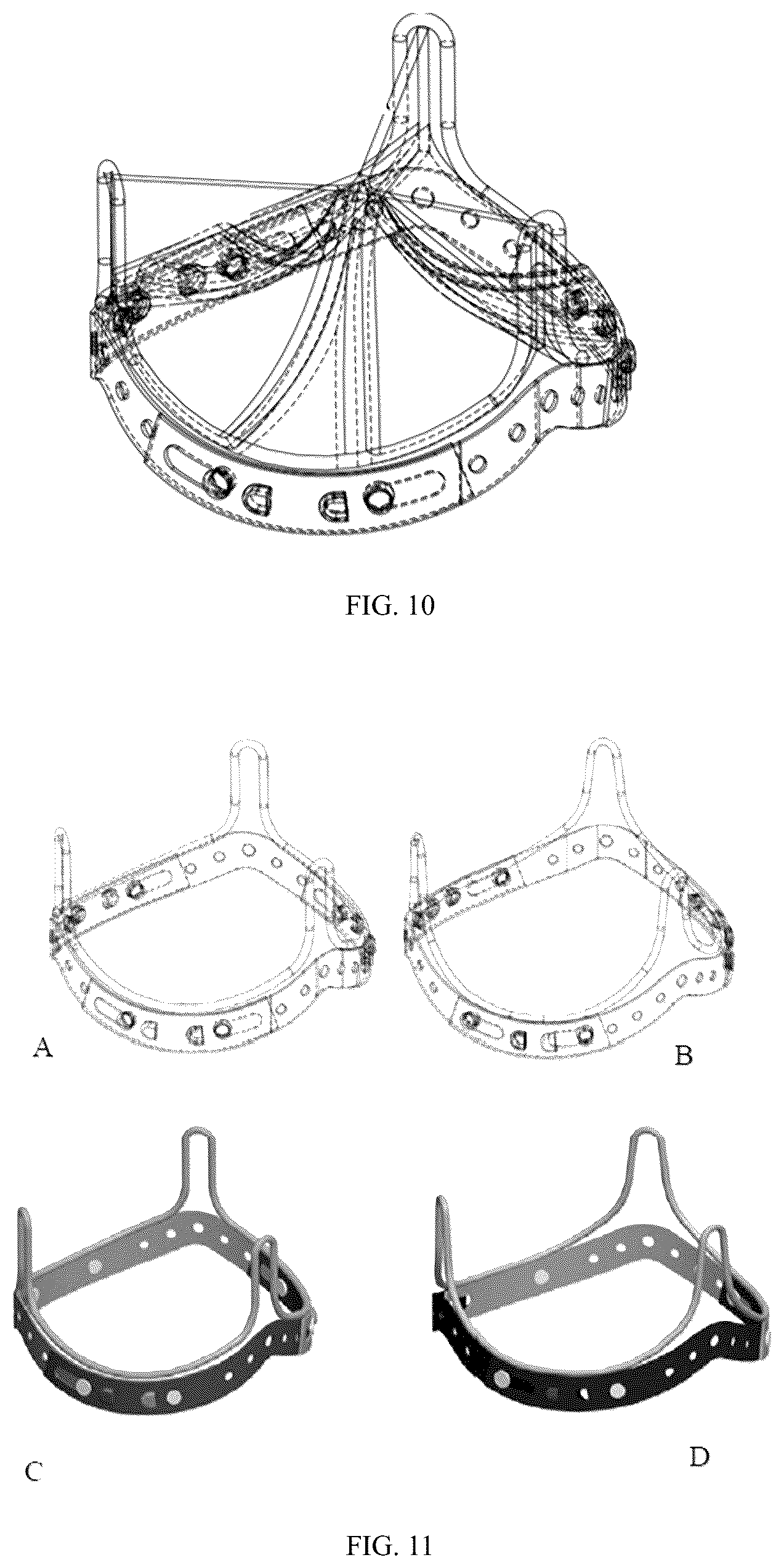 Patent US12303383 Figure 4 – One-way limiting expandable artificial biological heart valve