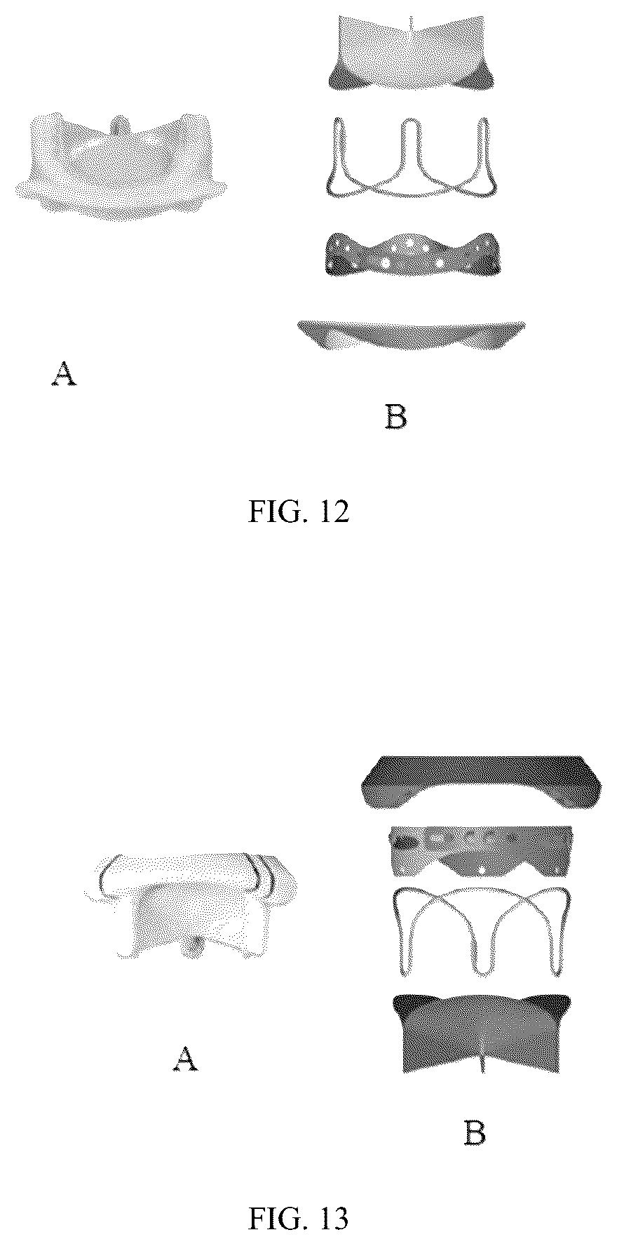 Patent US12303383 Figure 5 – One-way limiting expandable artificial biological heart valve