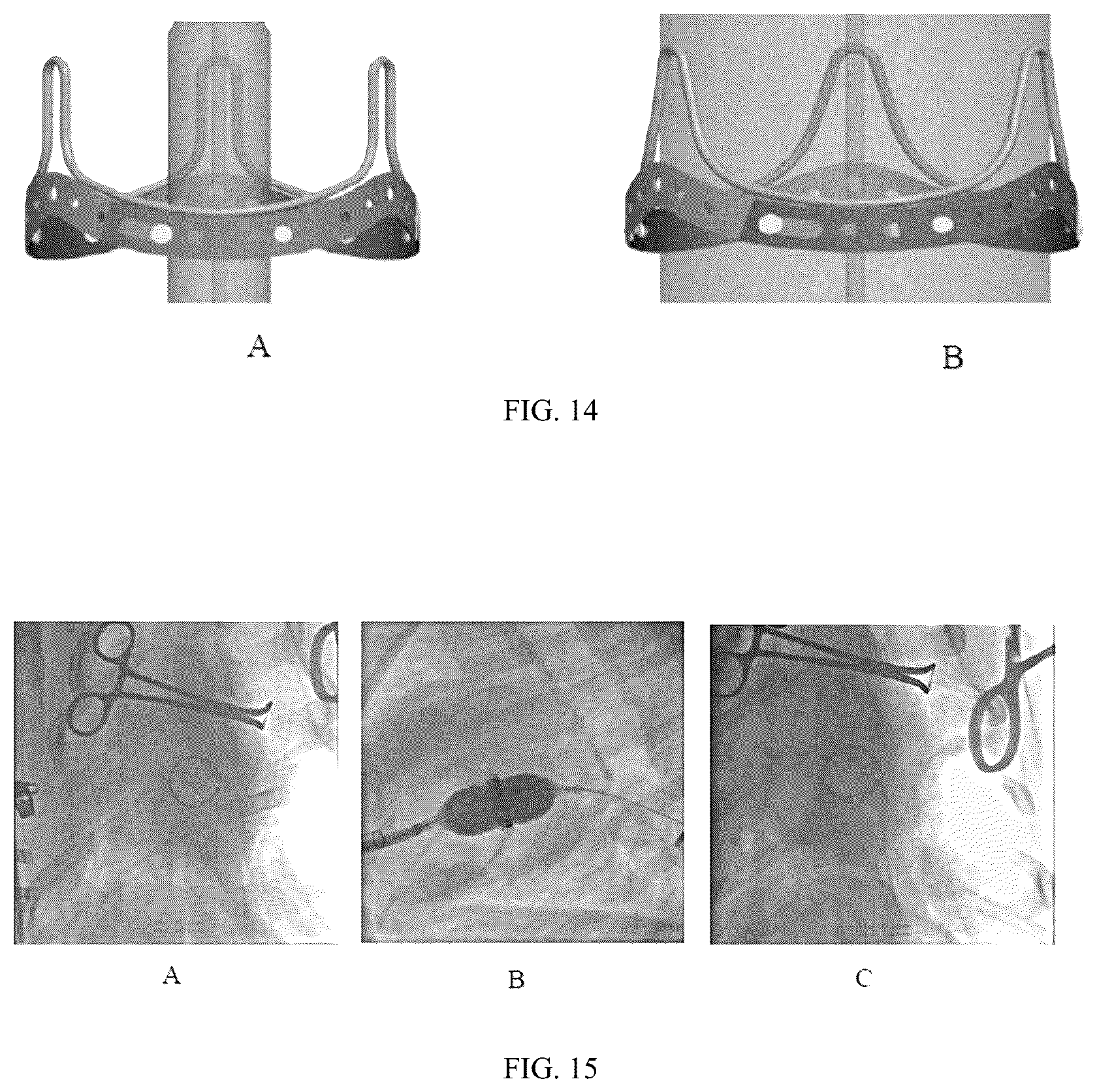 Patent US12303383 Figure 6 – One-way limiting expandable artificial biological heart valve