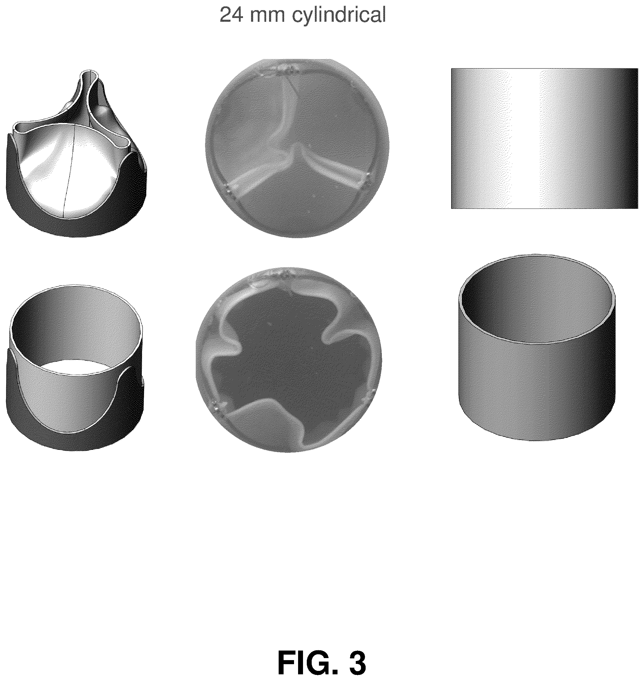 Patent US12303384 Figure 3 – Electrospun heart valves