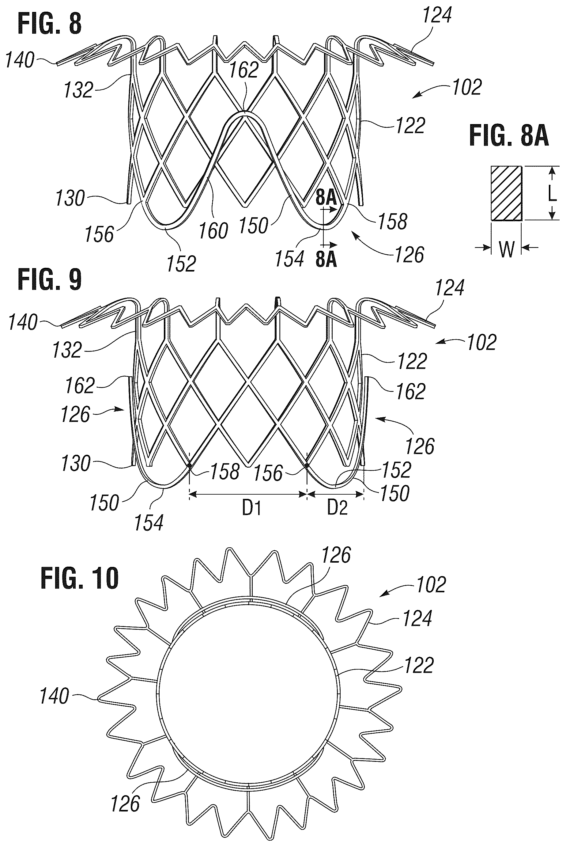 Patent US12303385 Figure 5 – Method of implanting a spacer body in a mitral valve