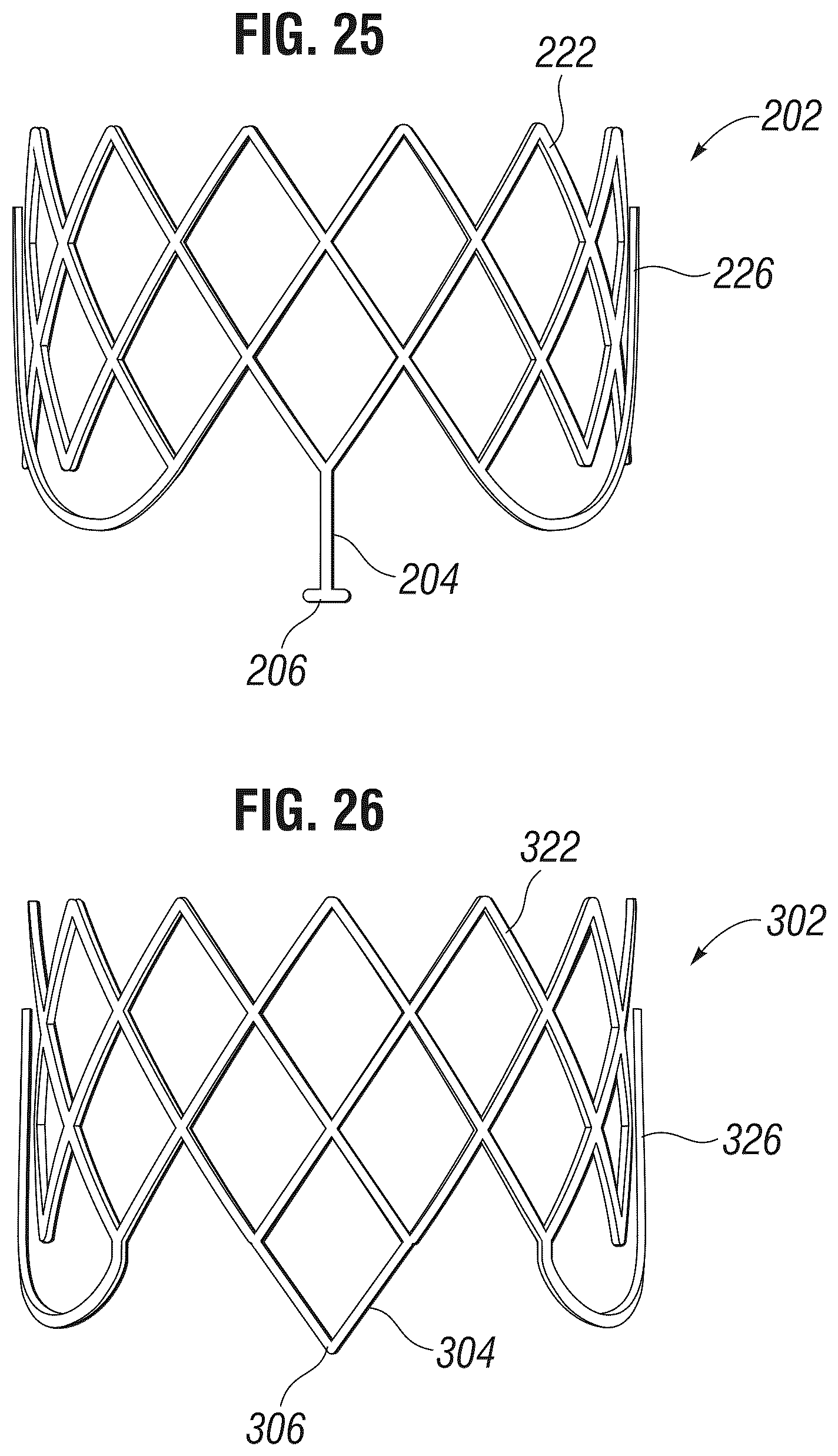 Patent US12303385 Figure 9 – Method of implanting a spacer body in a mitral valve