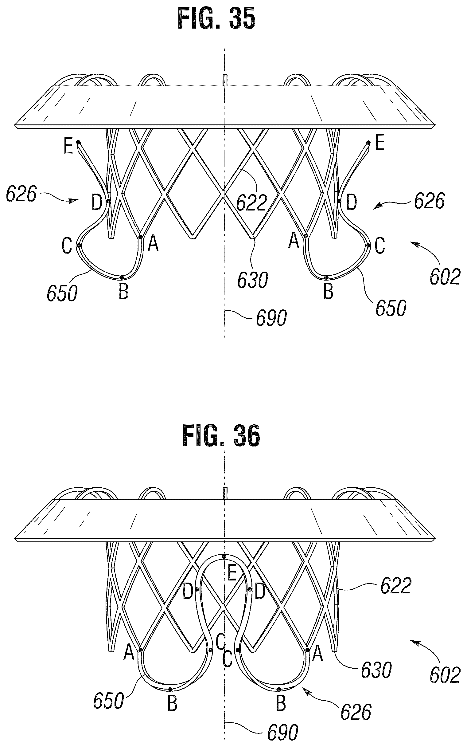 Patent US12303385 Figure 13 – Method of implanting a spacer body in a mitral valve