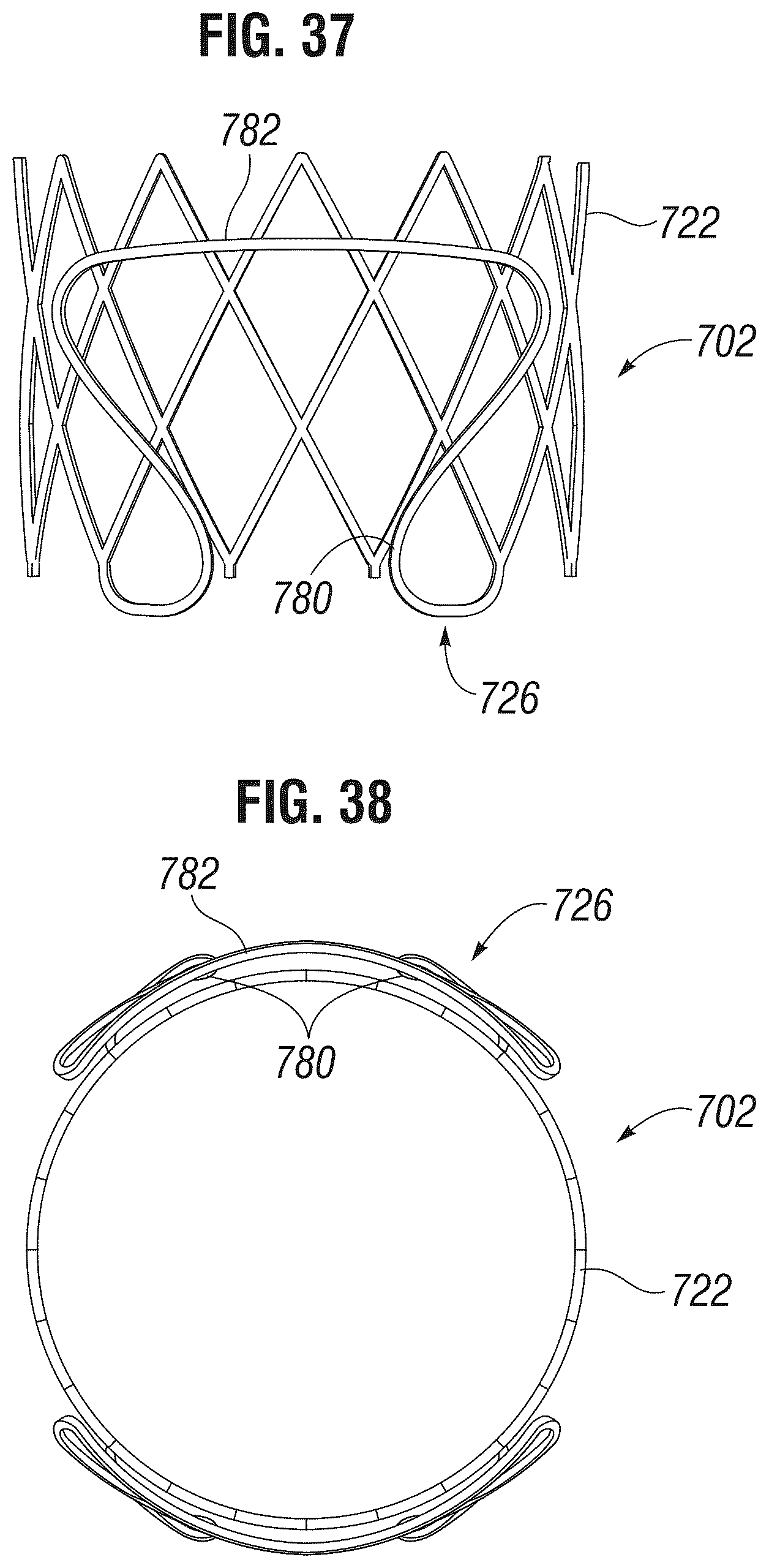 Patent US12303385 Figure 14 – Method of implanting a spacer body in a mitral valve