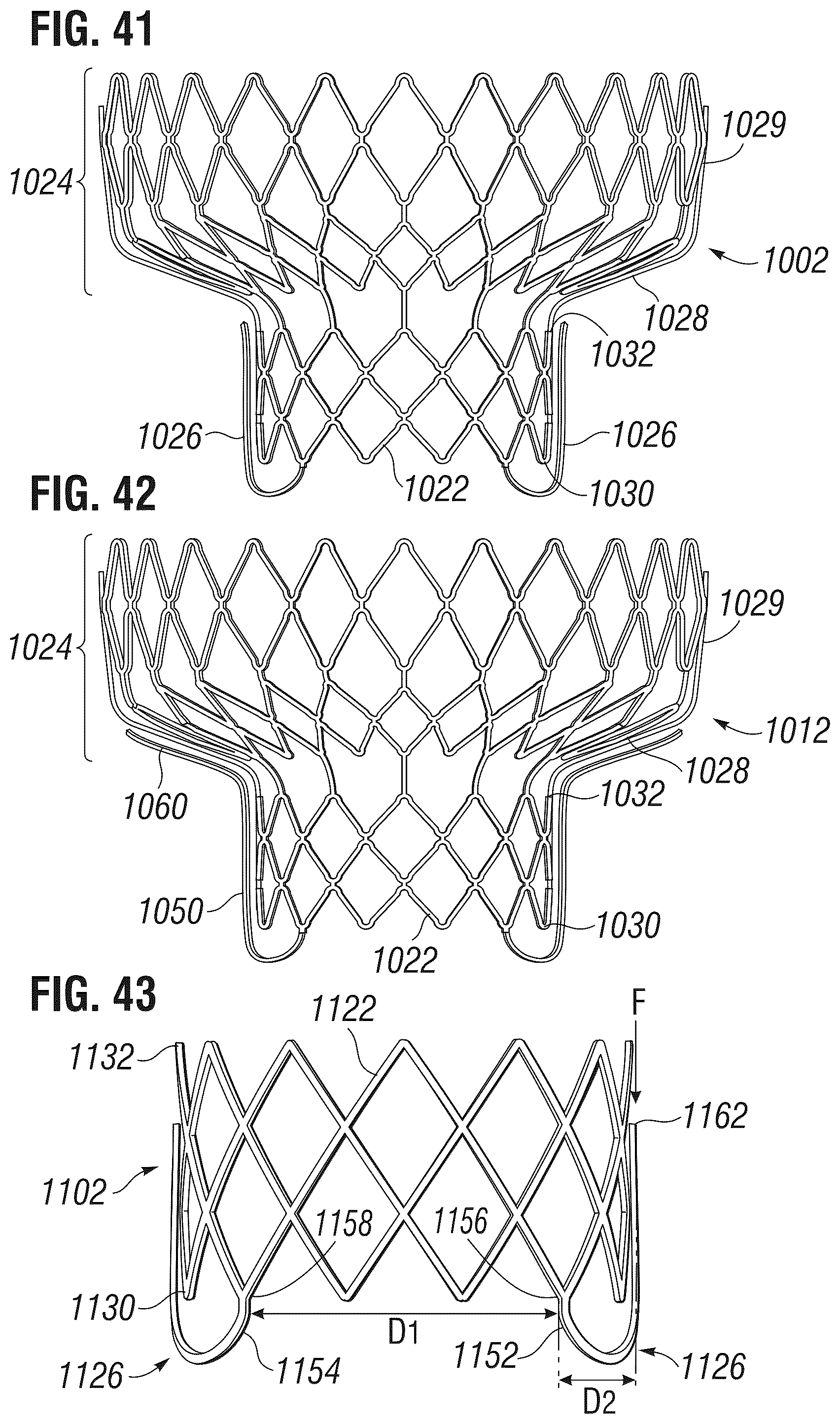 Patent US12303385 Figure 16 – Method of implanting a spacer body in a mitral valve
