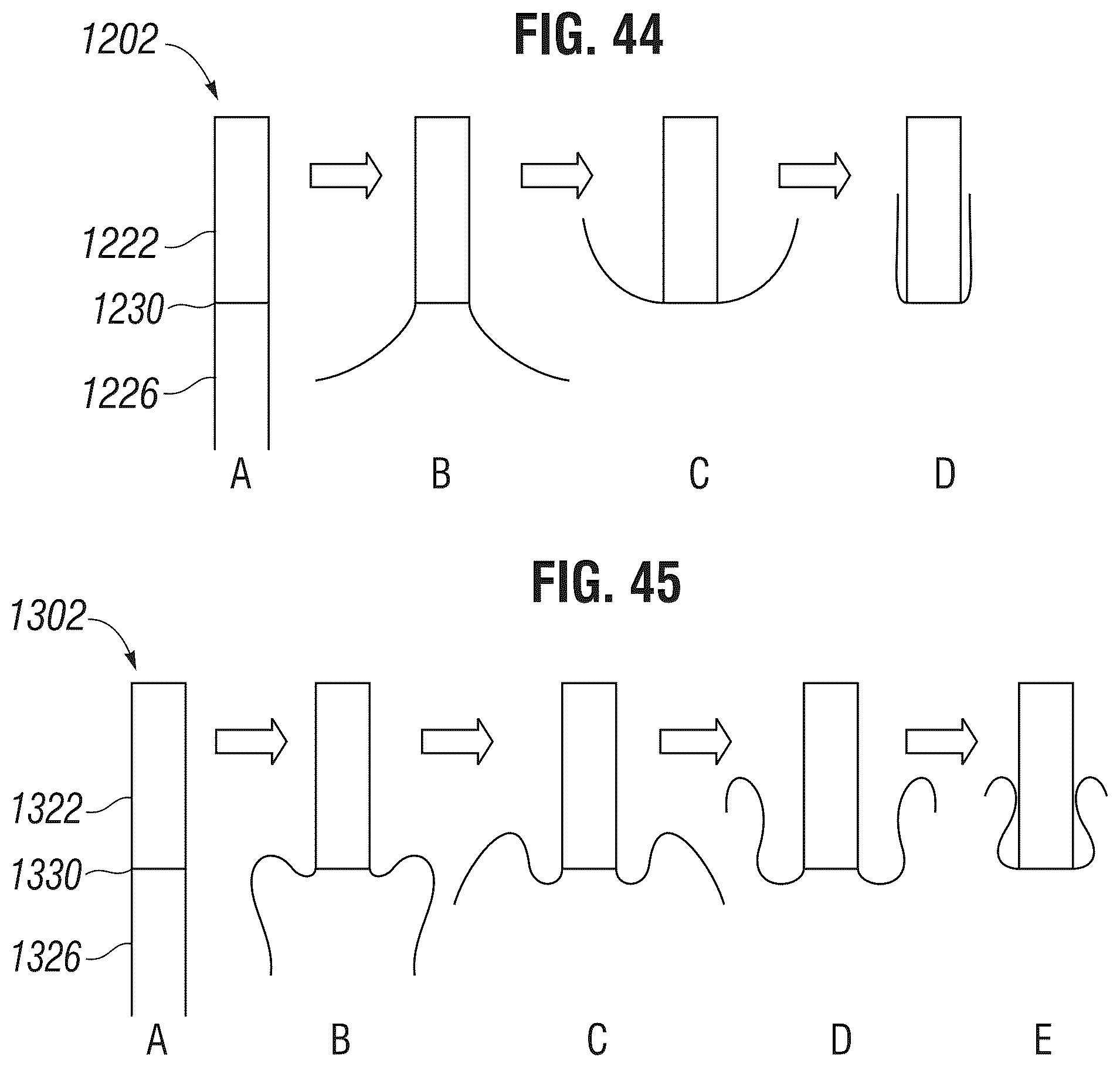 Patent US12303385 Figure 17 – Method of implanting a spacer body in a mitral valve
