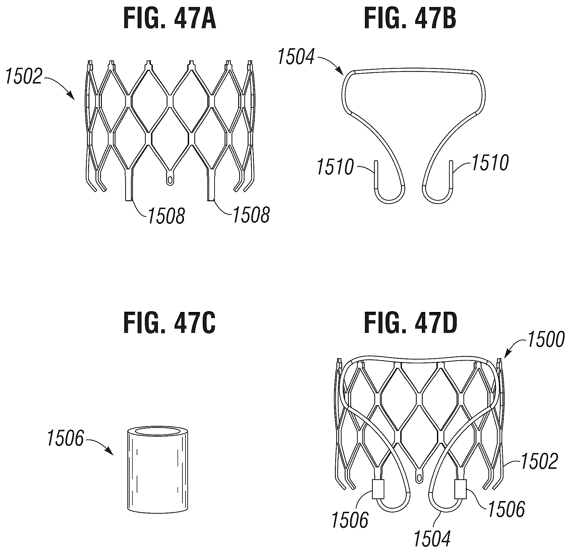 Patent US12303385 Figure 19 – Method of implanting a spacer body in a mitral valve
