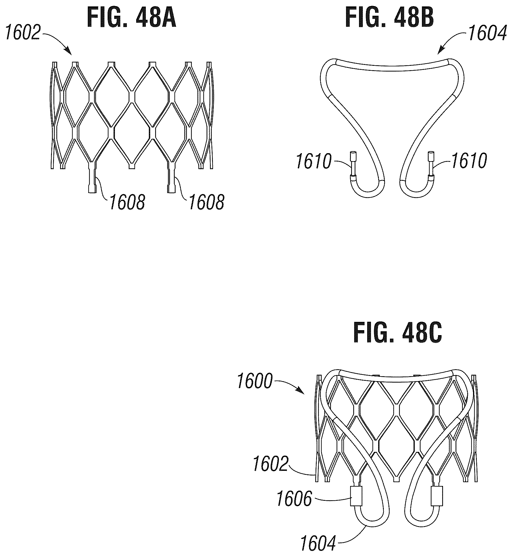 Patent US12303385 Figure 20 – Method of implanting a spacer body in a mitral valve
