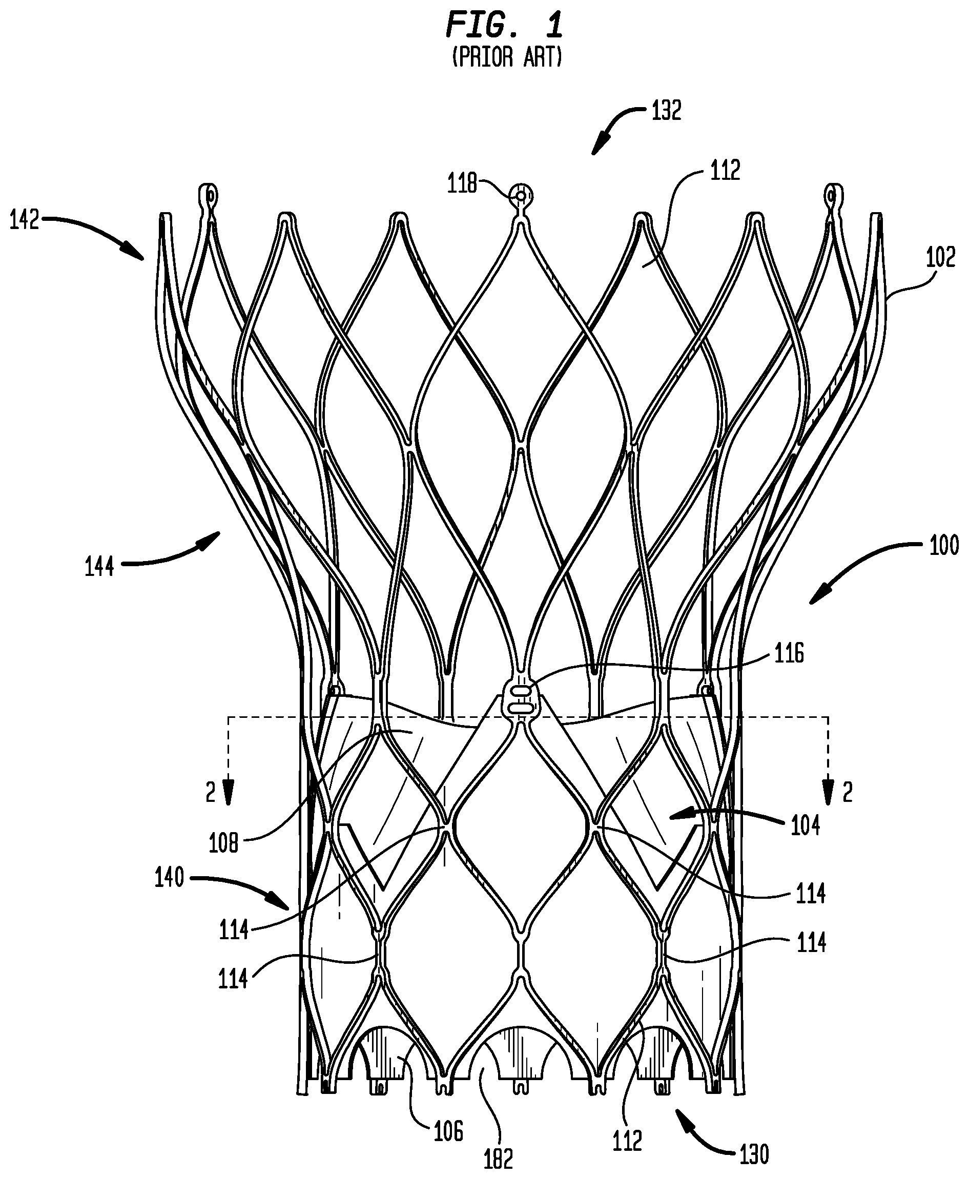 Patent US12303386 Figure 1 – Stent assembly for use in prosthetic heart valves