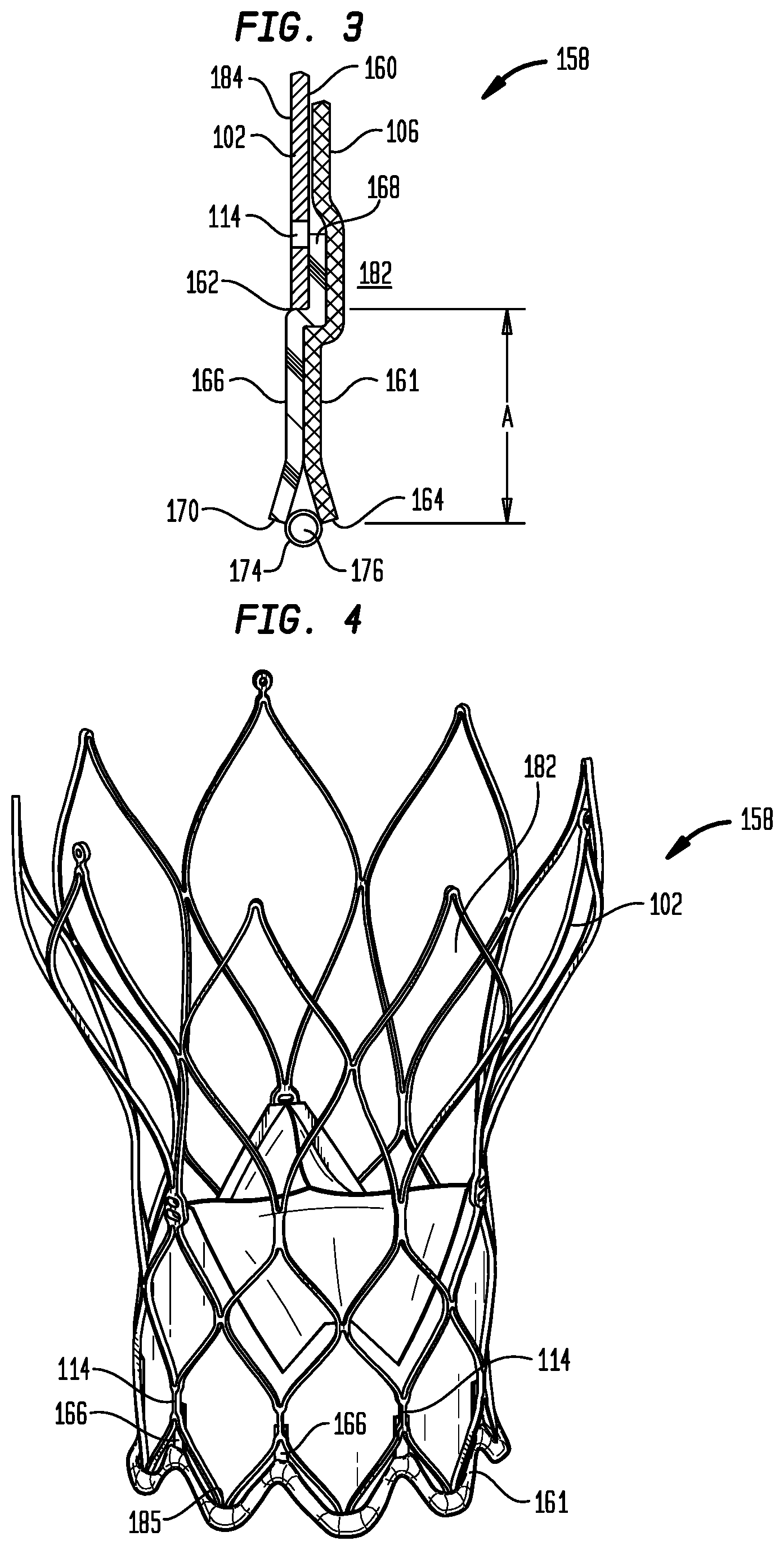 Patent US12303386 Figure 3 – Stent assembly for use in prosthetic heart valves
