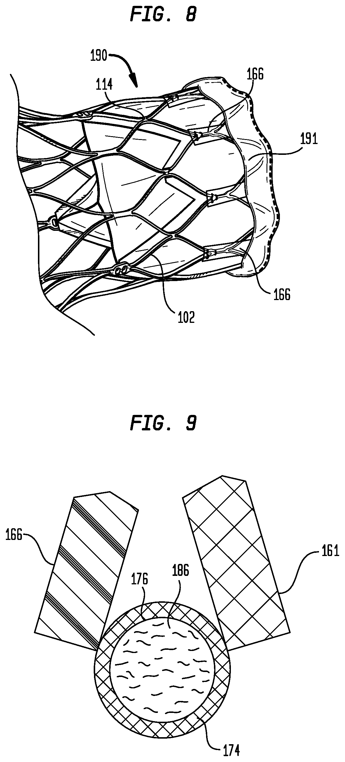 Patent US12303386 Figure 6 – Stent assembly for use in prosthetic heart valves
