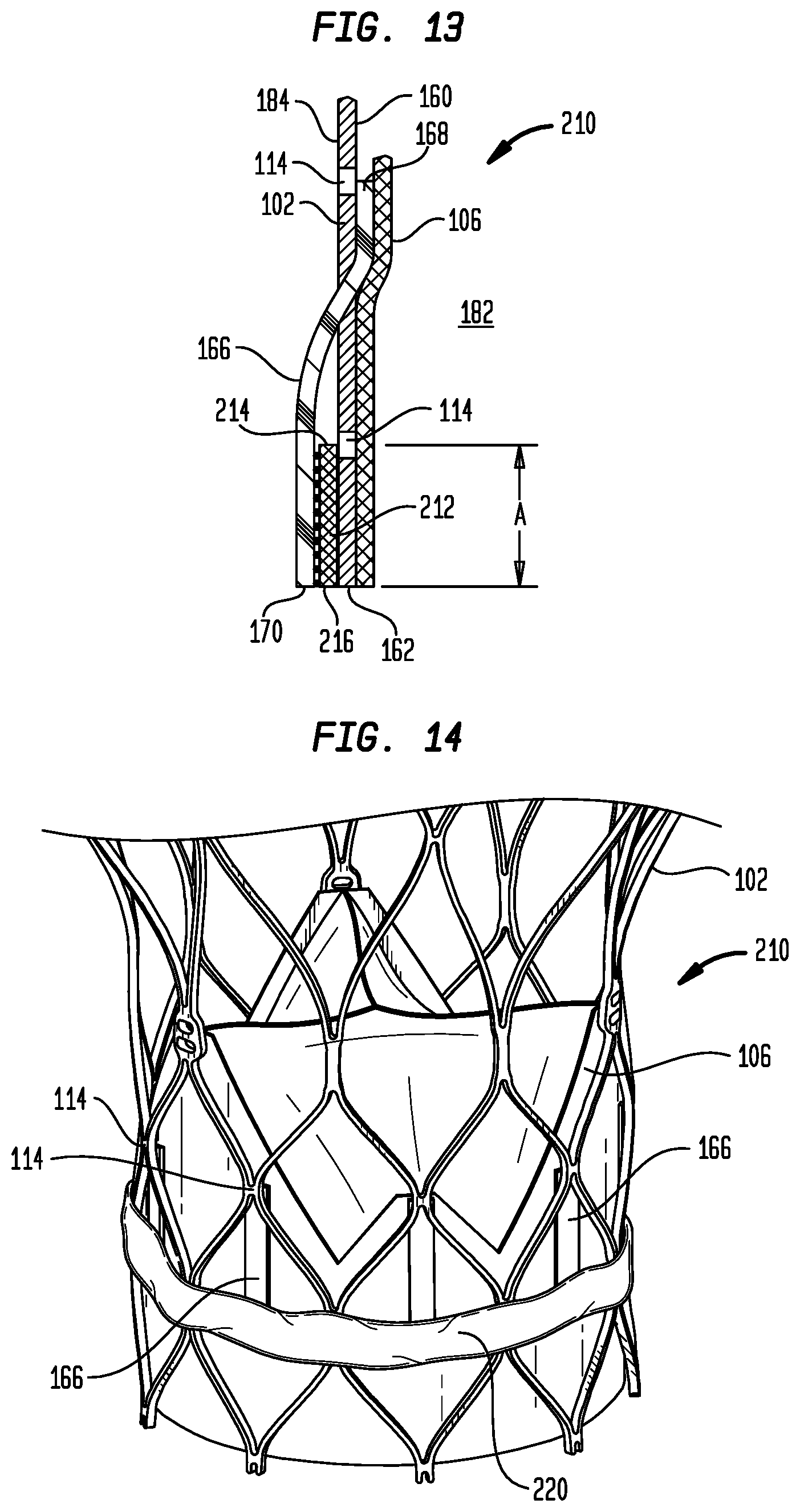 Patent US12303386 Figure 9 – Stent assembly for use in prosthetic heart valves