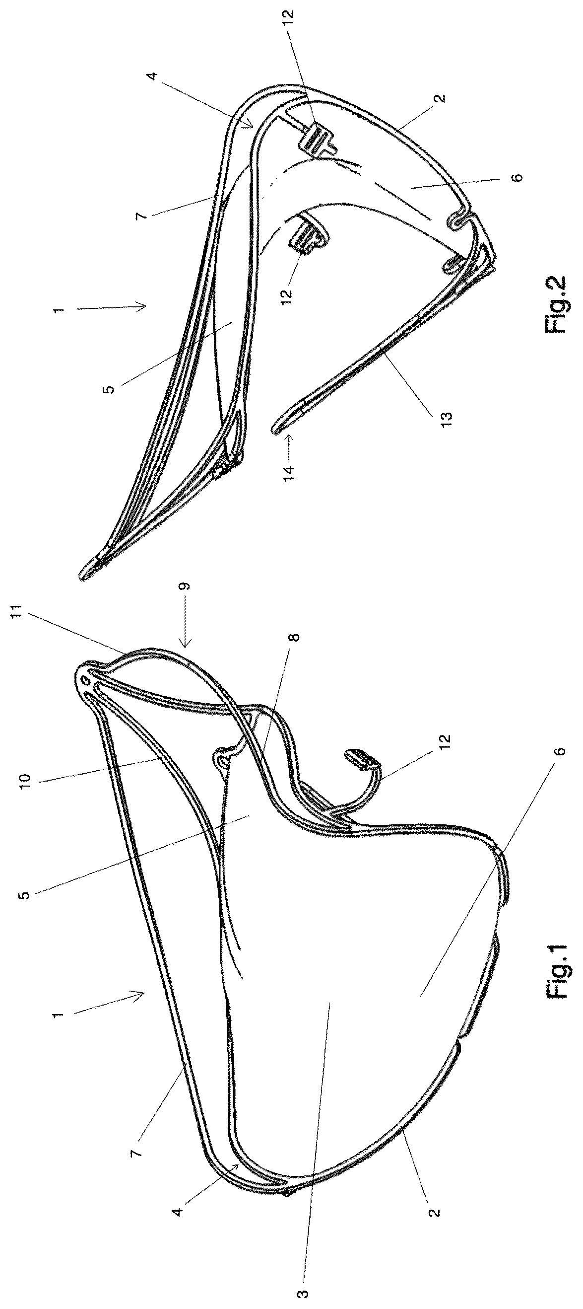 Patent US12303387 Figure 1 – Implant for improving coaptation of an atrioventricular valve