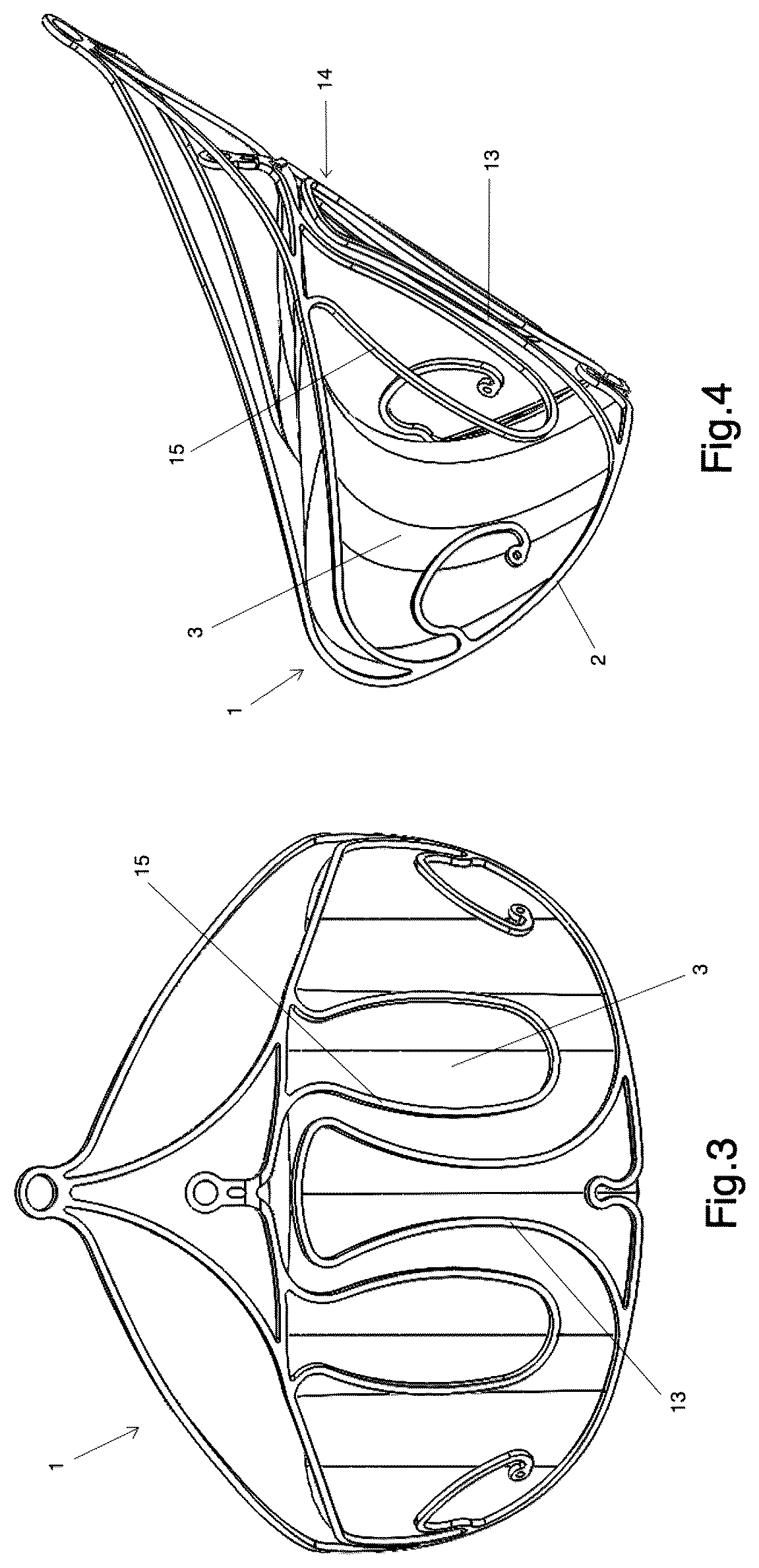 Patent US12303387 Figure 2 – Implant for improving coaptation of an atrioventricular valve